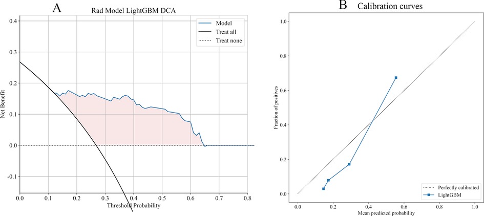 Two graphs are shown. Graph A is a Decision Curve Analysis for a Rad Model LightGBM, comparing net benefit against threshold probability. Three lines represent the model, treating all, and treating none. Graph B shows calibration curves with fraction of positives versus mean predicted probability for LightGBM, including a reference line for perfect calibration.