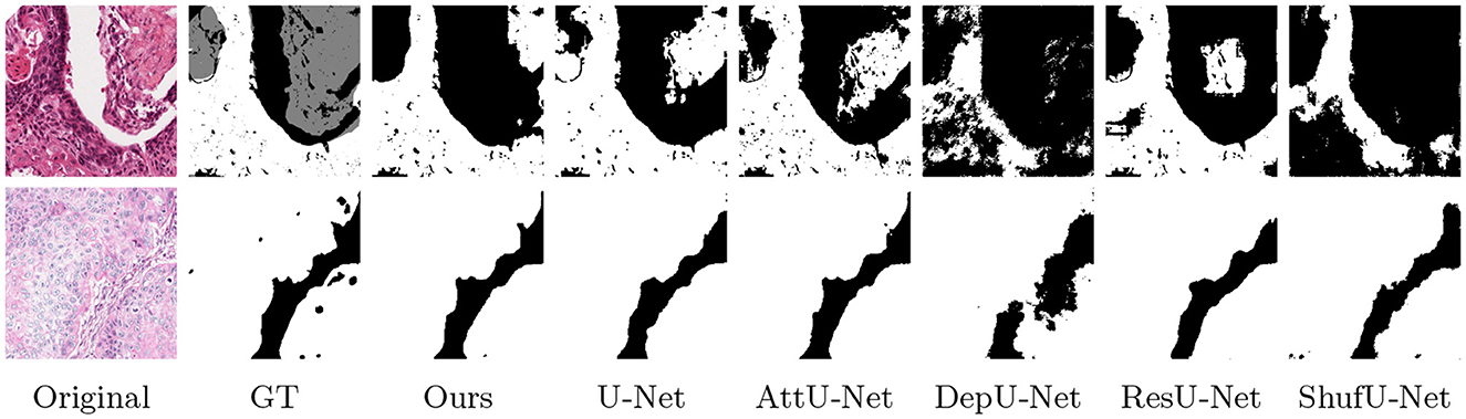Two rows of images comparing segmentation results. The first column shows the original histological images. The second column shows ground truth (GT) segmentations. The remaining columns depict results from different segmentation methods: Ours, U-Net, AttU-Net, DepU-Net, ResU-Net, and ShufU-Net. Black and white contrast highlights differences in segmentation accuracy among methods.