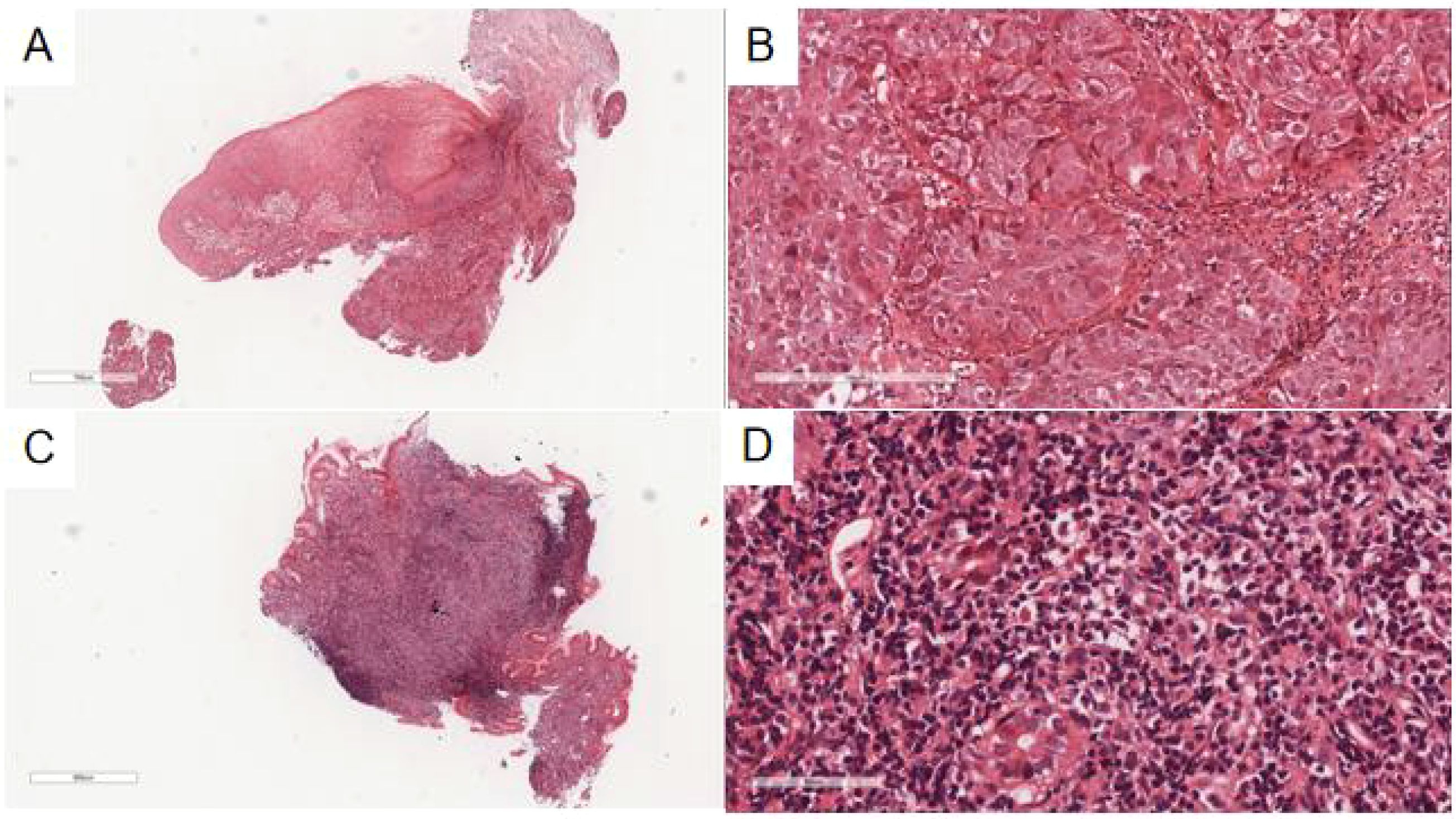 Histological slide images showing sections of tissue under a microscope. Panel A displays a large tissue section with a pink hue, while Panel B zooms in to show detailed cellular structure with prominent nuclei. Panel C presents another tissue section, appearing denser and darker, and Panel D focuses on cellular detail, revealing increased cell density and cluster formation, highlighting nuclei and cell boundaries.