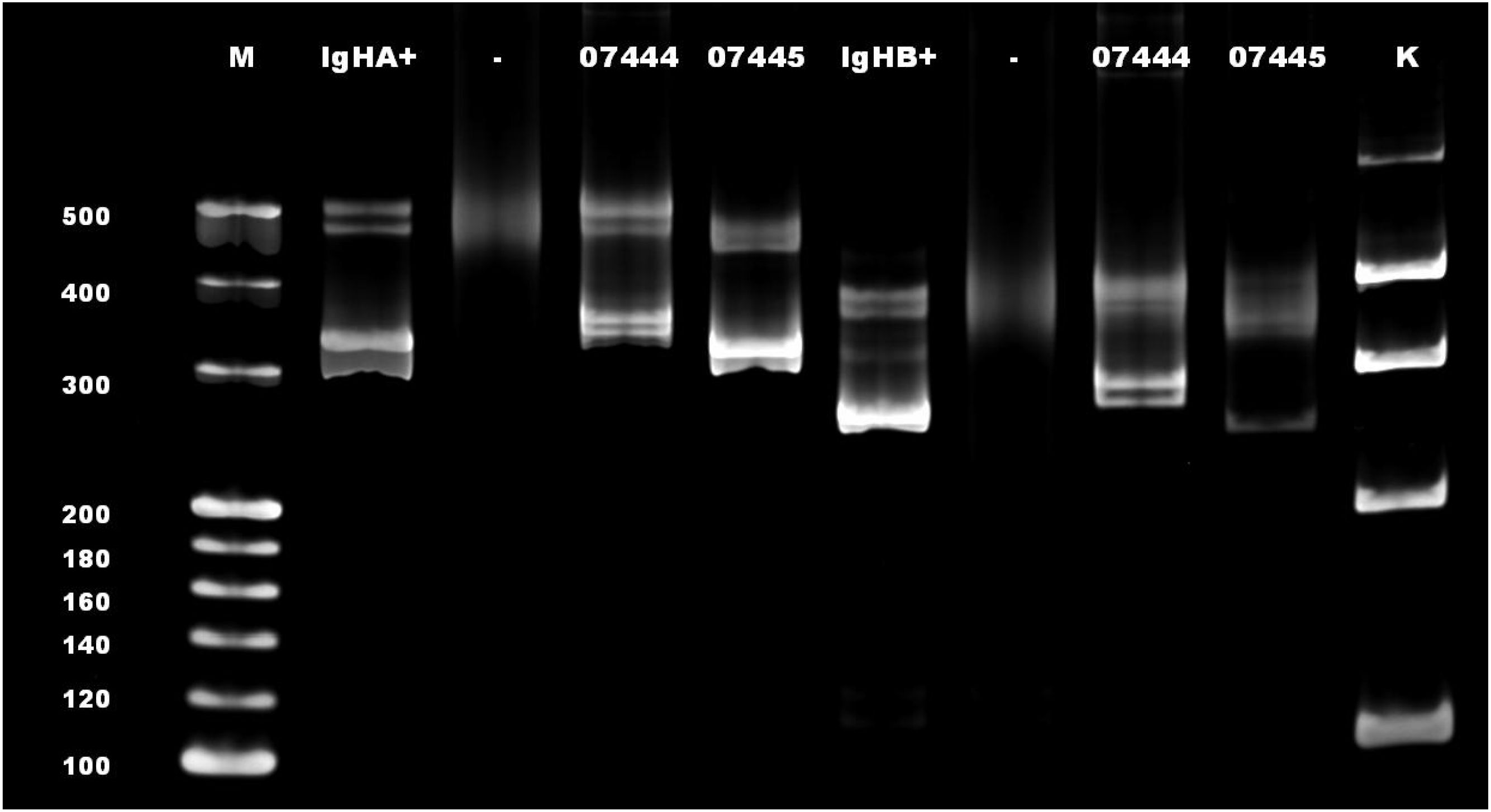 Gel electrophoresis image showing multiple lanes with DNA bands. Lanes labeled M, IgHA+, 07444, 07445, IgHB+, and K display distinct band patterns. Molecular weight markers are visible on the left, with sizes indicated from 100 to 500 base pairs.