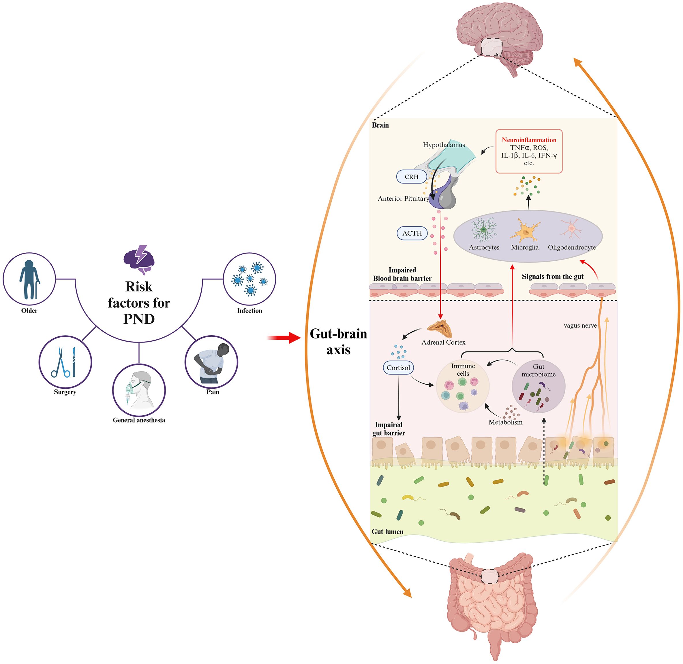 Diagram illustrating the gut-brain axis and risk factors for postoperative neurocognitive disorders (PND). On the left, risk factors include age, surgery, general anesthesia, pain, and infection. The gut-brain axis is shown on the right, highlighting how signals from the gut, including cortisol and immune cells, affect the brain, leading to neuroinflammation. The process involves the hypothalamus, pituitary, adrenal cortex, and impaired blood-brain and gut barriers, with interactions among astrocytes, microglia, and oligodendrocytes.