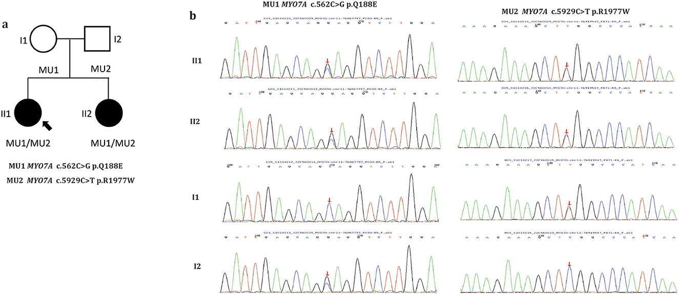 Panel A shows a pedigree chart illustrating the inheritance of mutations MU1 and MU2 in a family. Panel B displays sequence chromatograms for individuals II1, II2, I1, and I2, highlighting the specific mutations MU1 (MYO7A c.562C>G p.Q188E) and MU2 (MYO7A c.5929C>T p.R1977W) with red arrows. The chromatograms demonstrate how these mutations appear in the DNA sequence of each family member.