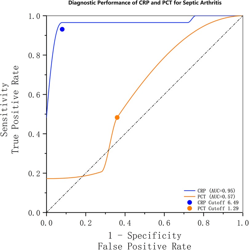 ROC curve comparing the diagnostic performance of CRP and PCT for septic arthritis. The CRP curve (blue) has an AUC of 0.95, while the PCT curve (orange) has an AUC of 0.57. Notable cutoff points marked are CRP at 6.49 and PCT at 1.29. The plot includes a diagonal reference line.