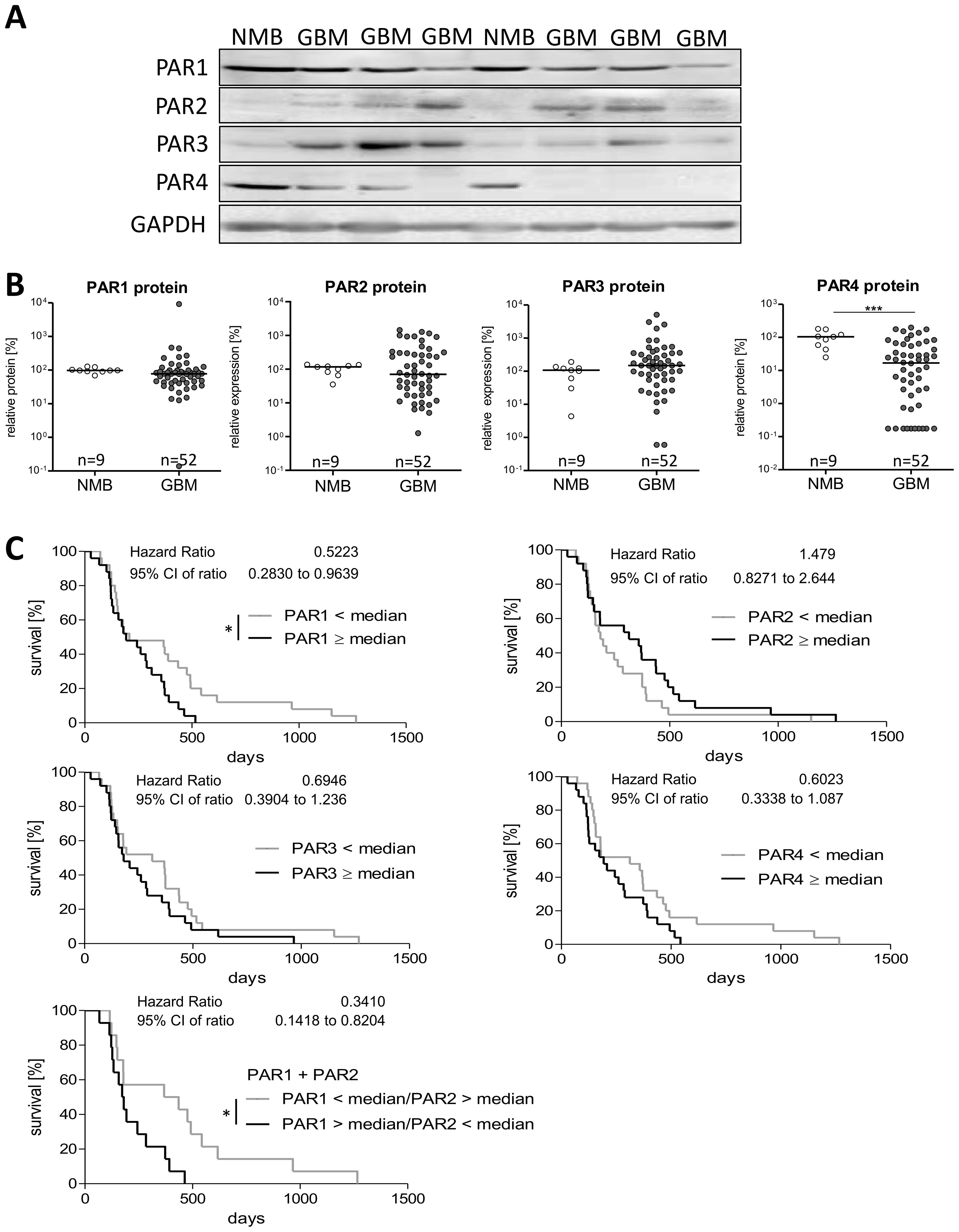Panel A shows a Western blot analysis of PAR1, PAR2, PAR3, PAR4, and GAPDH in NMB and GBM samples. Panel B presents scatter plots displaying relative protein expression levels of PAR1, PAR2, PAR3, and PAR4 in NMB and GBM groups, with significantly higher expressions in GBM. Panel C contains Kaplan-Meier survival curves comparing the survival probability of patients with different median expression levels of PAR1, PAR2, PAR3, and PAR4, where lower expression of PAR1 alone, and in combination with PAR2, correlates with better survival.