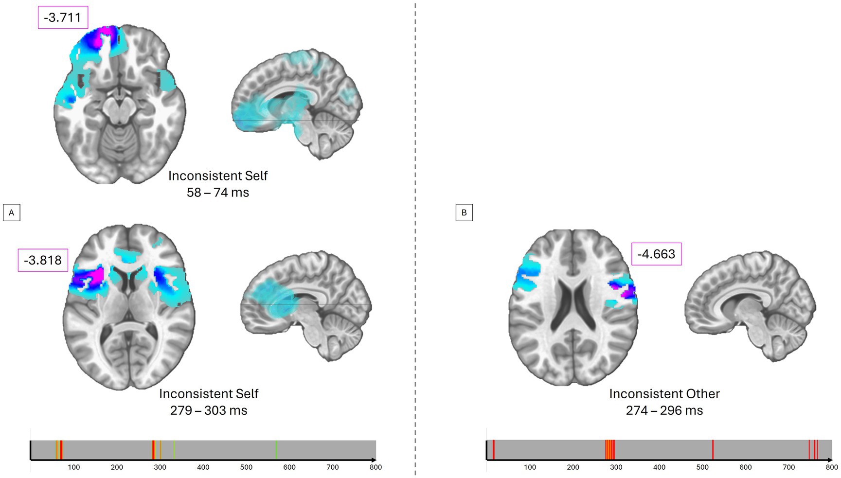 Brain scans showing activation areas in two conditions: Panel A depicts