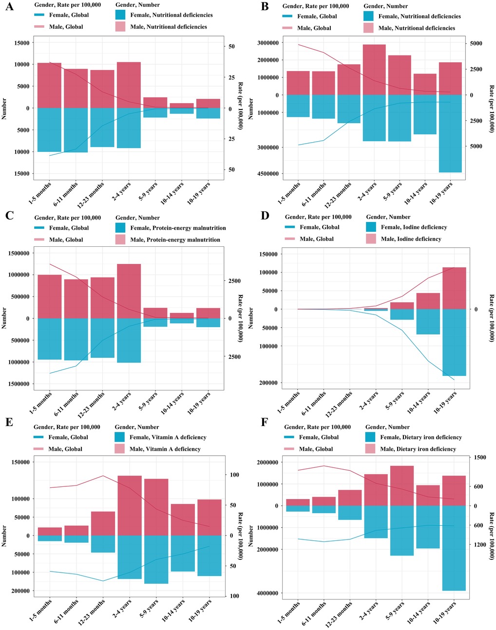 Six bar charts depict nutritional deficiencies across various age groups, differentiated by gender. Chart A shows nutritional deficiencies, Chart B iodine deficiency, Chart C protein-energy malnutrition, Chart D iodine deficiency, Chart E vitamin A deficiency, and Chart F dietary iron deficiency. Each chart compares global and gender-specific data using red for females and blue for males. The x-axis contains age groups, while the y-axis shows numbers and rates per hundred thousand.