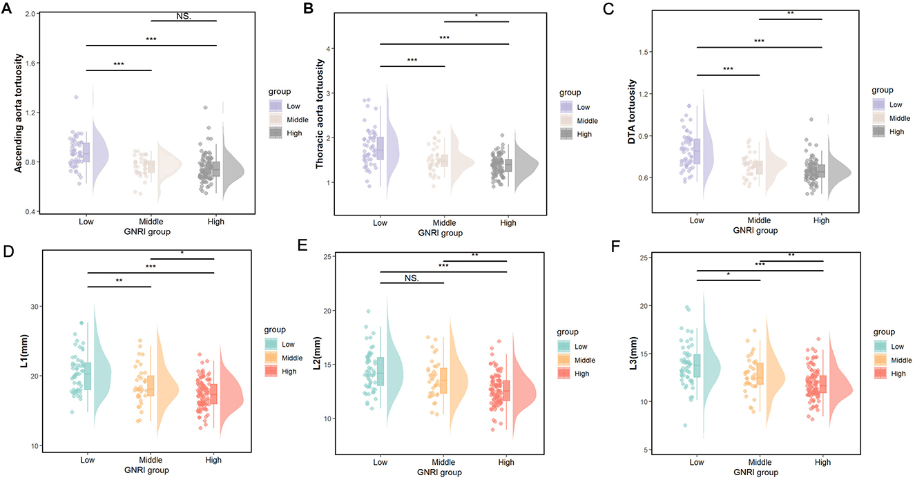 Violin plots illustrate the distribution of aortic tortuosity and other measurements across GNRI groups labeled low, middle, and high. Plots A to C show varying levels of ascending and arcus aorta, thoracic aorta, and DTA tortuosity. Plots D to F depict L1, L2, and L3 measurements in millimeters. Each plot displays significance levels with lines marked as NS, *, **, and ***. Data points are color-coded for each group.