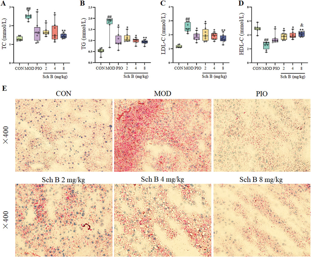 Box plots and histological images show the effects of Sch B on lipid levels and liver tissue. Graphs (A-D) illustrate changes in TC, TG, LDL-C, and HDL-C across different groups and dosages. Histological images (E) at 400x magnification display liver sections from control, model, PIO, and Sch B treatment groups, highlighting variations in tissue structure and lipid accumulation.
