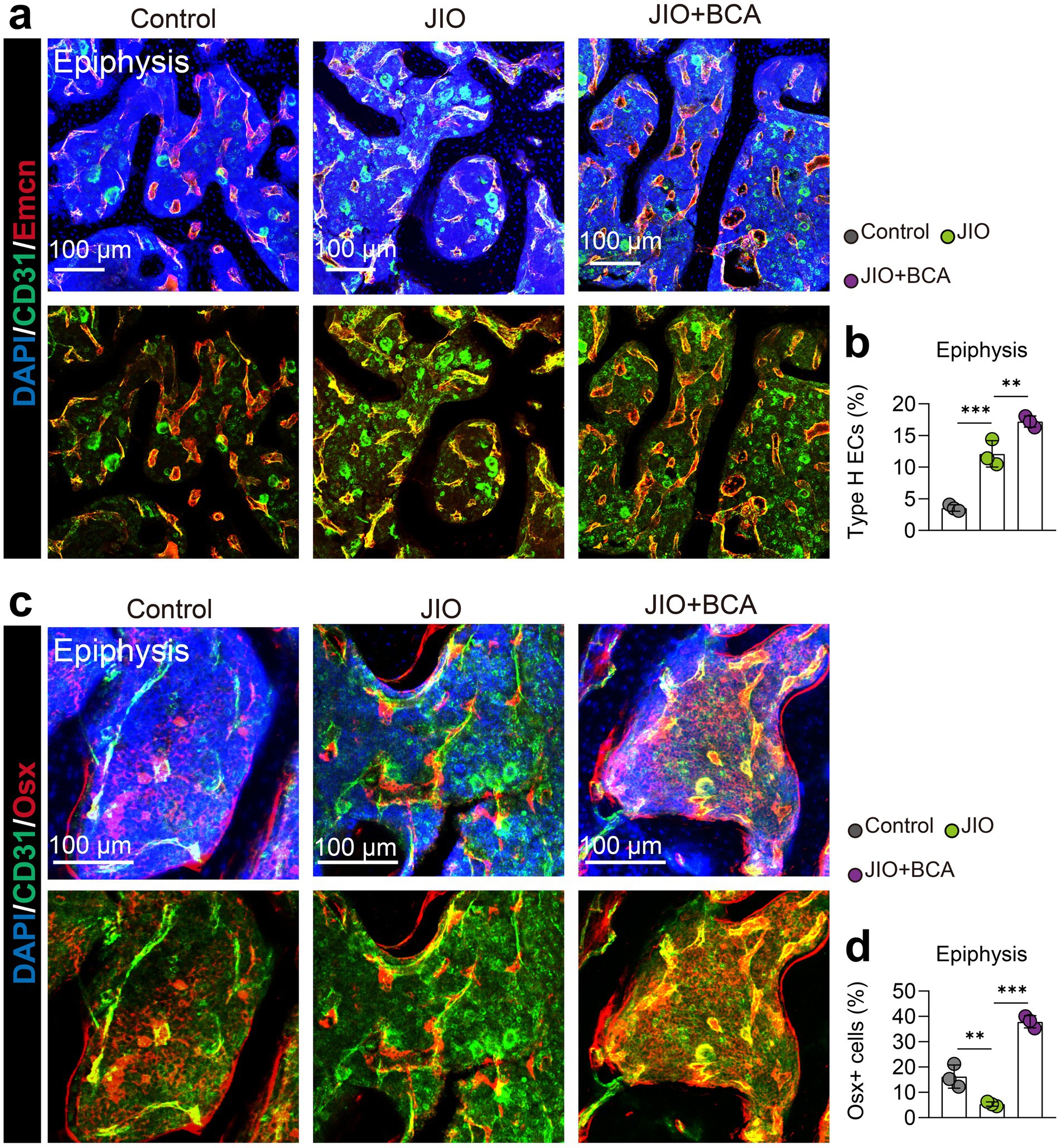 Panels a and c contain fluorescent images of epiphysis tissues under different conditions: Control, JIO, and JIO+BCA. Panel a shows staining for Emcn (red) and CD31 (green), with DAPI (blue) for nuclei. Panel b displays a bar graph of the percentage of Type H endothelial cells, with significant increases in JIO and JIO+BCA groups. Panel c displays staining for Osx (red) with CD31 (green) and DAPI (blue). Panel d shows a bar graph of the percentage of Osx+ cells, with marked increases in JIO and JIO+BCA. Scale bars indicate 100 micrometers.