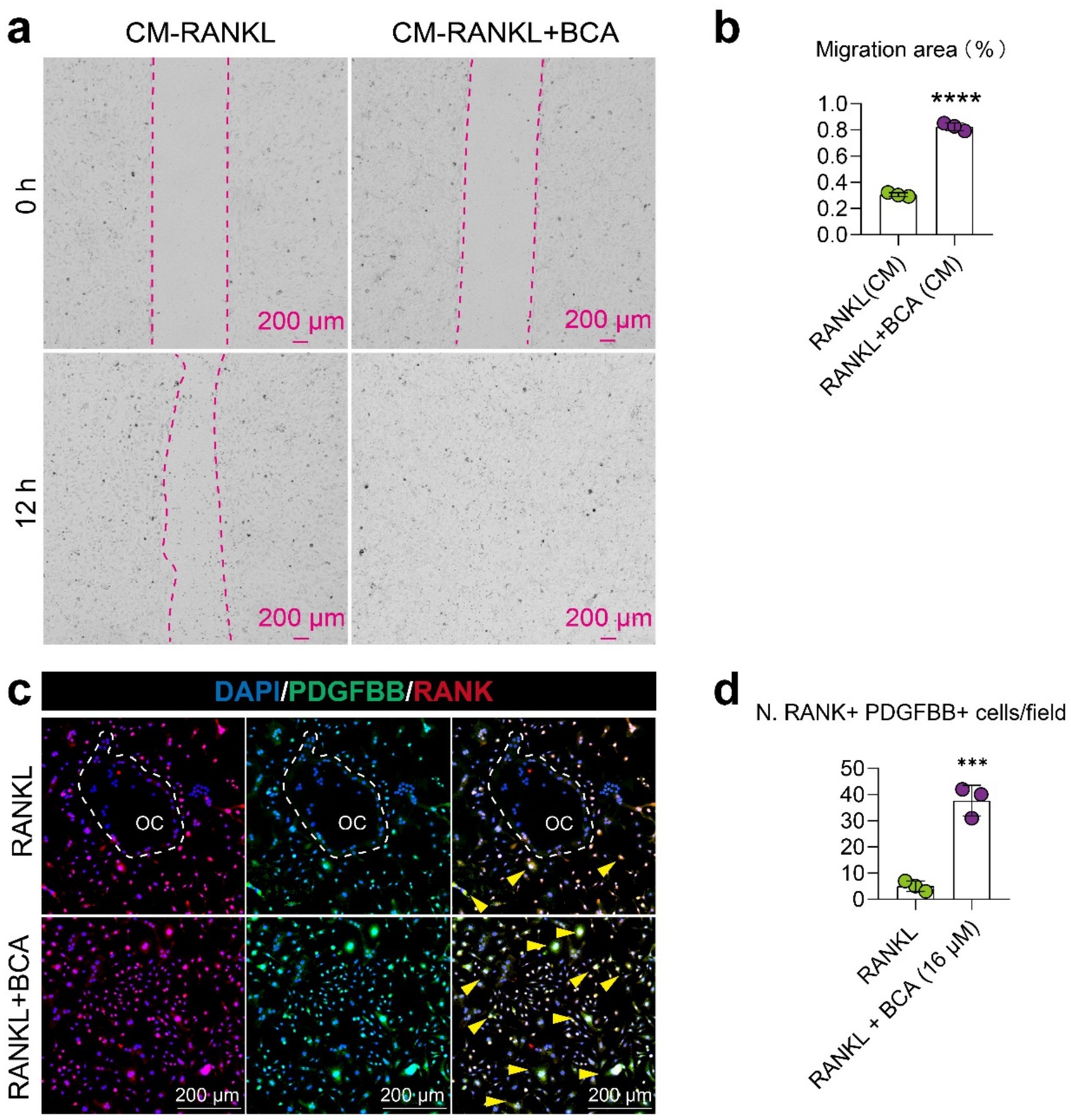 Panel (a) shows cell migration assays with images captured at 0 and 12 hours for CM-RANKL and CM-RANKL+BCA conditions, with dashed pink lines indicating areas of interest. Panel (b) presents a bar graph comparing the migration area percentage between RANKL(CM) and RANKL+BCA(CM), indicating significant differences. Panel (c) displays immunofluorescence images for DAPI, PDGFBB, and RANK markers, highlighting differences in cell localization between conditions RANKL and RANKL+BCA, with yellow arrows pointing to cells of interest. Panel (d) is a bar graph showing the number of RANK+ PDGFBB+ cells per field, indicating a significant increase in the RANKL+BCA condition.
