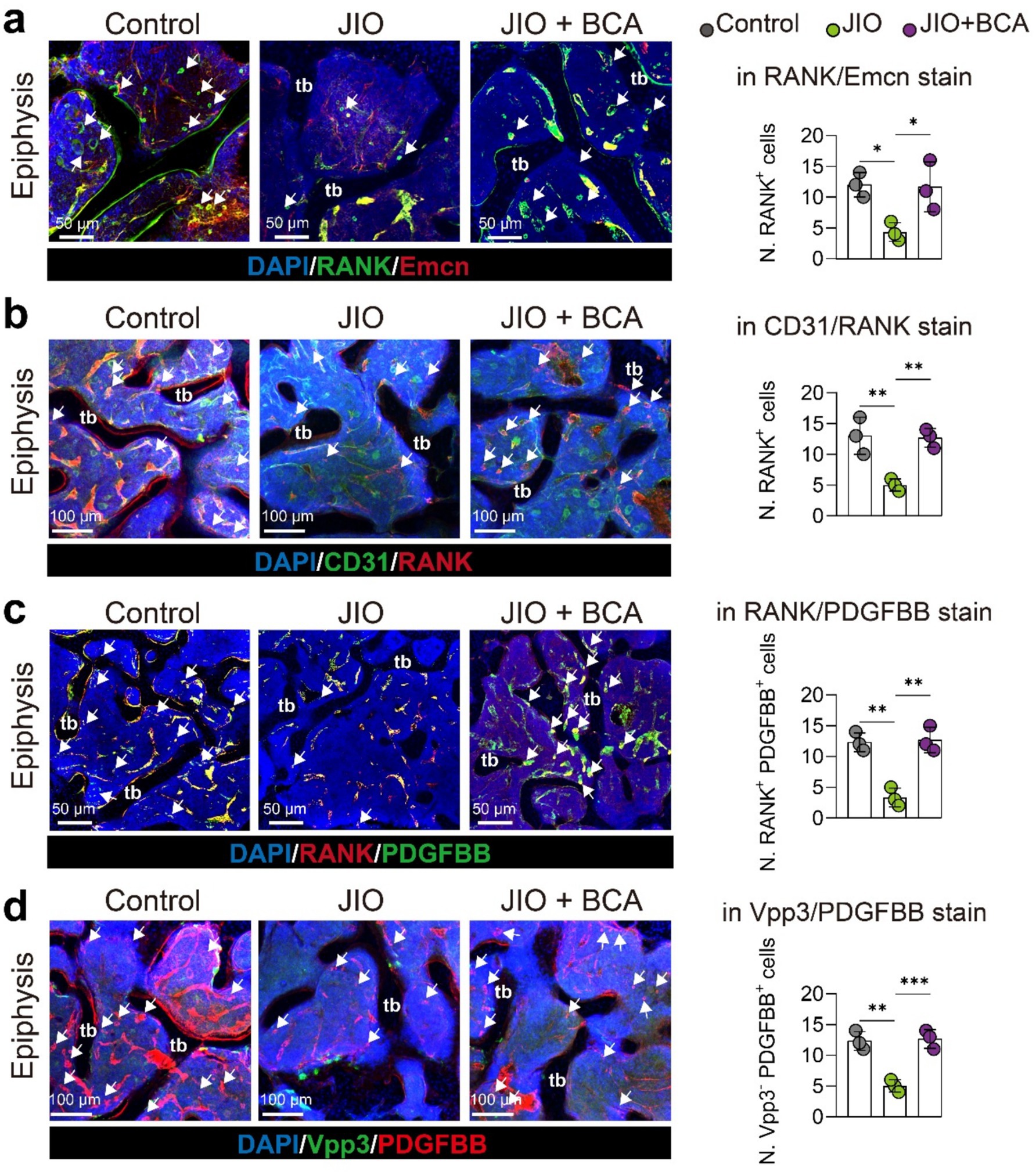 Four panels show epiphysis tissue sections with different staining: (a) RANK/Emcn, (b) CD31/RANK, (c) RANK/PDGFBB, and (d) Vpp3/PDGFBB. Each panel compares Control, JIO, and JIO + BCA groups with corresponding bar graphs showing quantification of RANK\(^+\) or PDGFBB\(^+\) cells. Significant differences are indicated with asterisks.