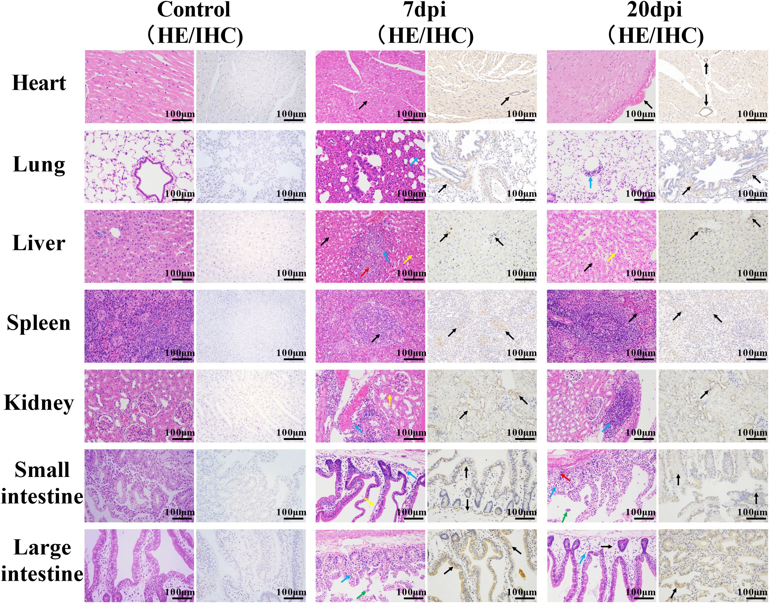 Histological images of various organs (heart, lung, liver, spleen, kidney, small intestine, large intestine) under different conditions. The left column shows control images, the middle column shows changes at seven days post-infection (dpi), and the right column at twenty dpi. Each column includes Hematoxylin and Eosin (HE) staining and Immunohistochemistry (IHC) results. Black arrows and color markers indicate notable features or changes, with a scale of one hundred micrometers.