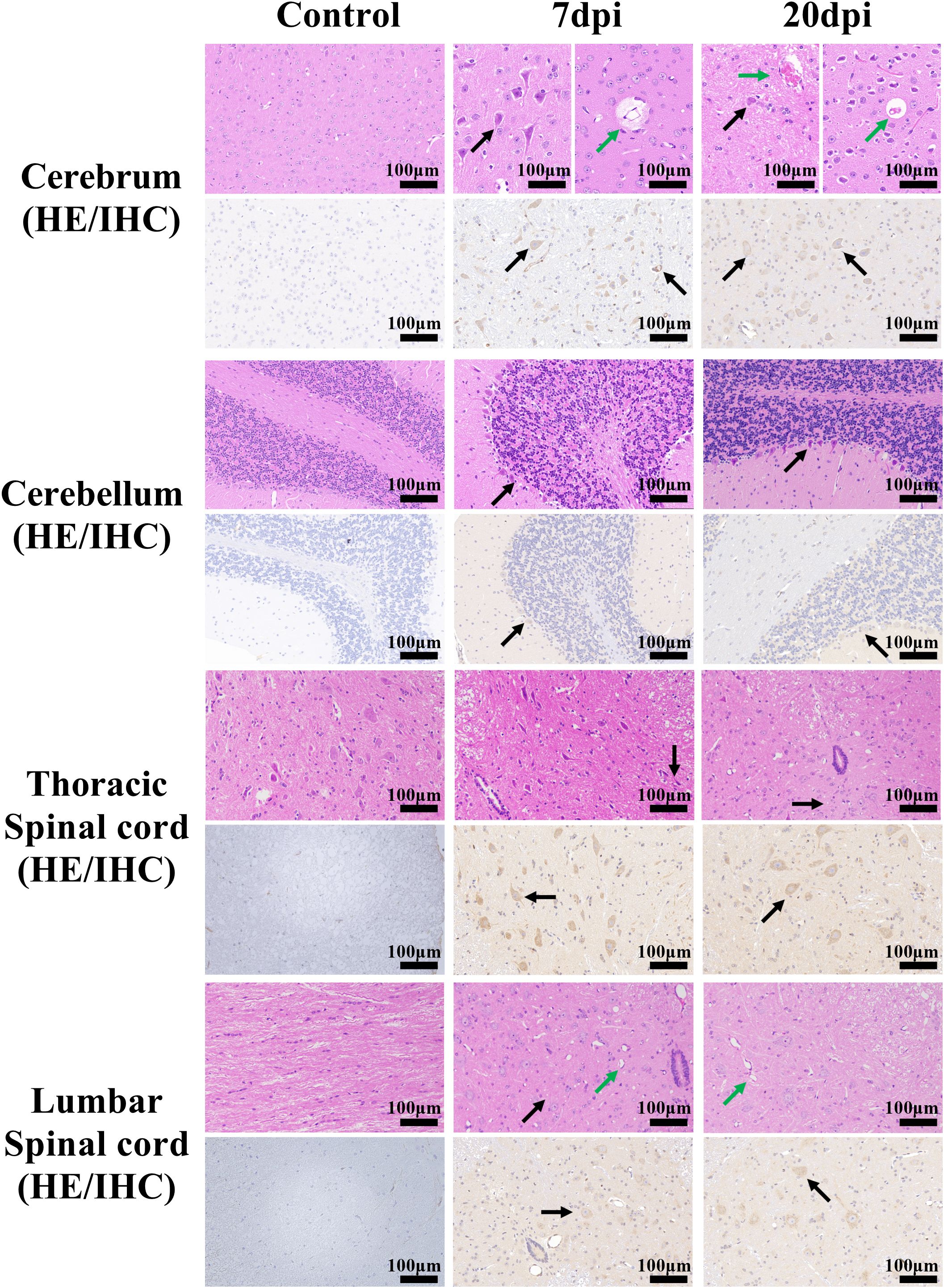 Histological image panels show brain and spinal cord sections at different stages: control, seven days post-infection (dpi), and twenty dpi. Each section, stained with HE/IHC, illustrates changes in the cerebrum, cerebellum, thoracic, and lumbar spinal cord. Arrows indicate specific cellular or structural features across stages, with scale bars at 100 micrometers.
