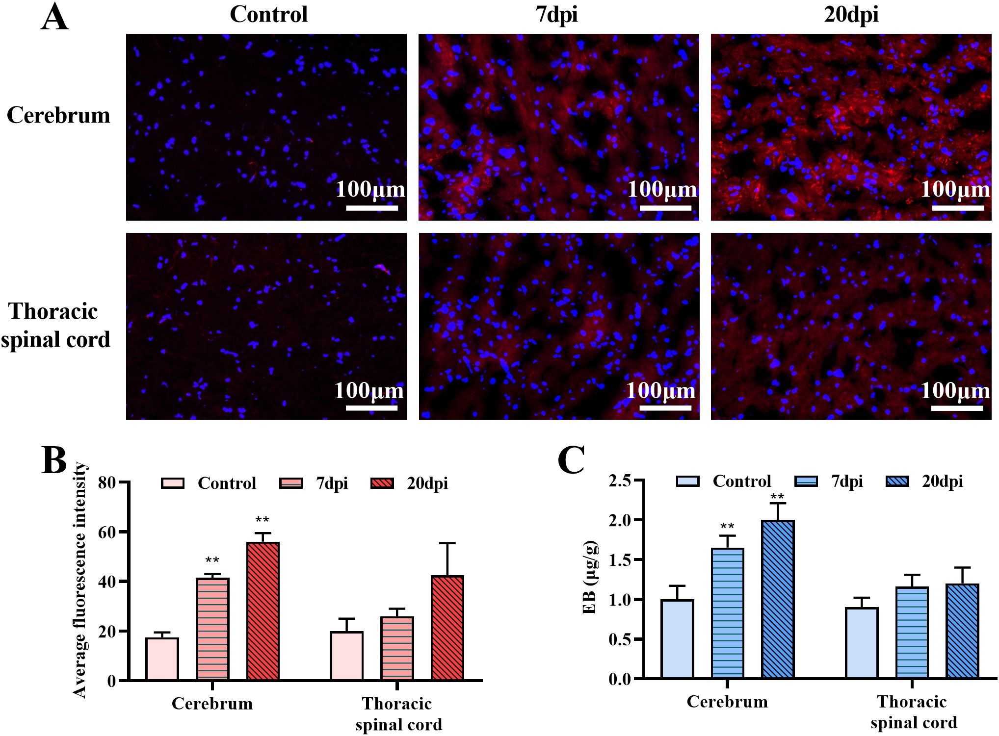 Fluorescent microscopy images and bar graphs showing cerebrum and thoracic spinal cord samples. Panel A shows control, 7 days post-injury (dpi), and 20 dpi samples with red and blue staining. Panel B shows average fluorescence intensity, indicating a significant increase in the cerebrum at 7 and 20 dpi. Panel C shows Evans Blue (EB) content, with significant increases in the cerebrum at 7 and 20 dpi. Scale bars indicate 100 micrometers.
