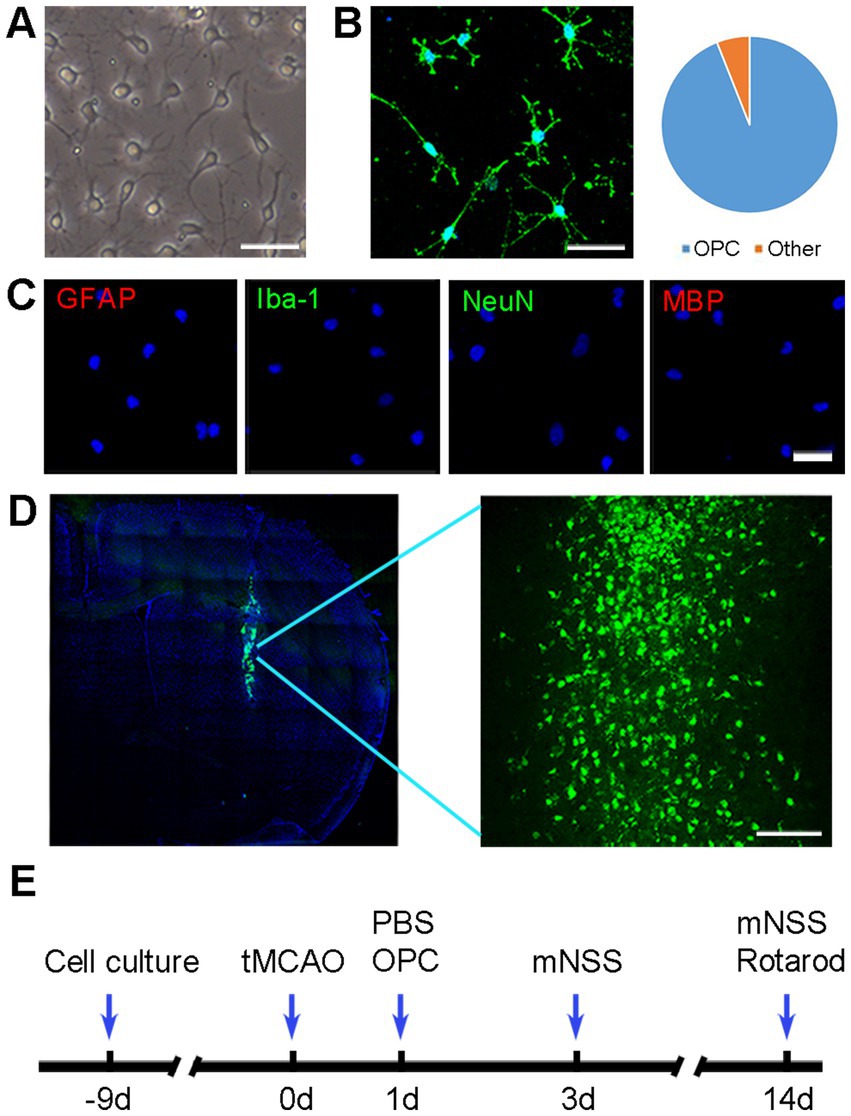 Panel A shows cultured cells with round and elongated shapes. Panel B displays green-stained cells, with a pie chart indicating a majority are OPCs. Panel C features four images of cell markers: GFAP and MBP in red, Iba-1 and NeuN in green, alongside blue-stained nuclei. Panel D presents a brain section with a magnified area showing green-stained cells. Panel E illustrates a timeline of experimental procedures, including cell culture, tMCAO, PBS and OPC treatment, and mNSS and rotarod tests at specific intervals.