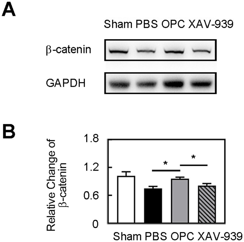 Western blot and bar graph analysis of β-catenin expression. Panel A shows β-catenin and GAPDH bands under different treatments: Sham, PBS, OPC, and XAV-939. Panel B presents a bar graph of the relative change in β-catenin levels for each condition. Asterisks indicate significant differences.
