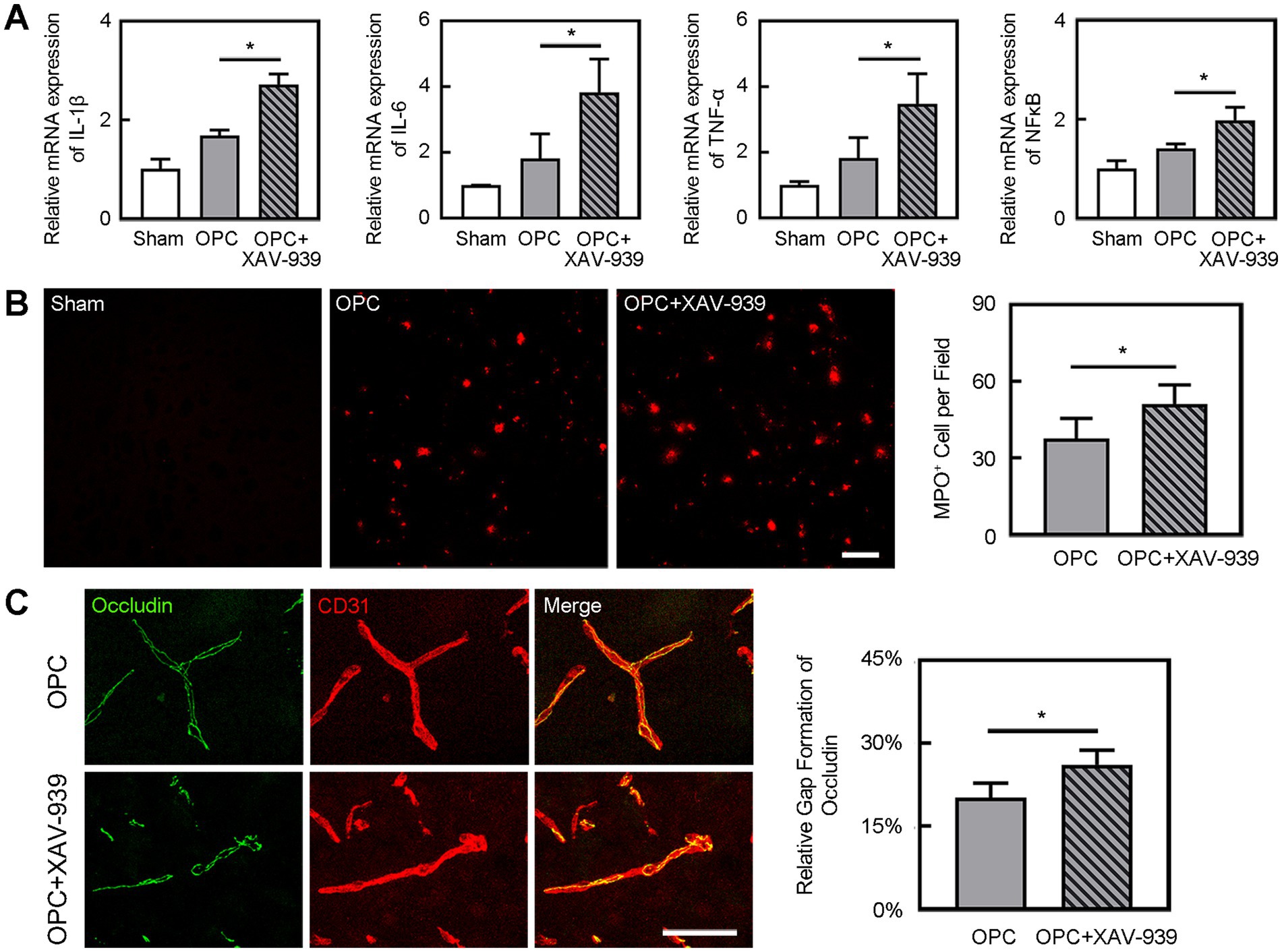 Graphical and microscopic representations illustrate the effects of XAV-939 on inflammation and cell structure in OPC conditions. Panel A shows bar graphs indicating significant increases in mRNA expression of IL-1β, IL-6, TNF-α, TNF, and NFĸB in OPC plus XAV-939 treatments compared to OPC and sham. Panel B displays fluorescent microscopy images showing an increased number of MPO-positive cells in OPC plus XAV-939 samples, supported by a bar graph quantifying this increase. Panel C includes fluorescent images showing occludin and CD31 expression, with a bar graph demonstrating increased occludin gap formation in OPC plus XAV-939 conditions.