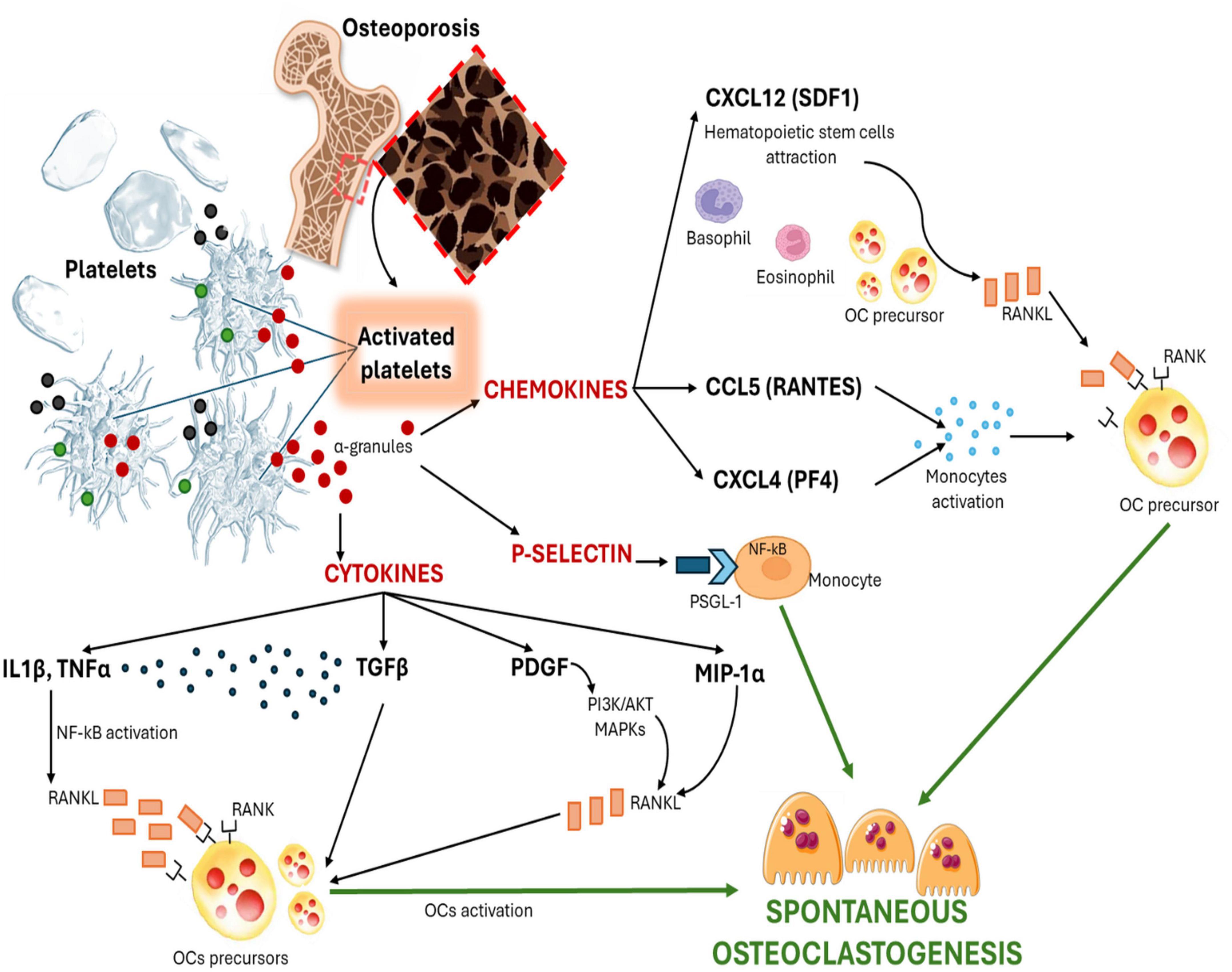 Flowchart depicting the role of activated platelets in osteoporosis. It shows activated platelets releasing chemokines and cytokines, influencing monocyte activation and OC precursor differentiation. The pathways lead to spontaneous osteoclastogenesis, with involvement of molecules such as CXCL12, CCL5, IL1β, TNFα, and MIP-1α. Arrows indicate the direction of interactions.