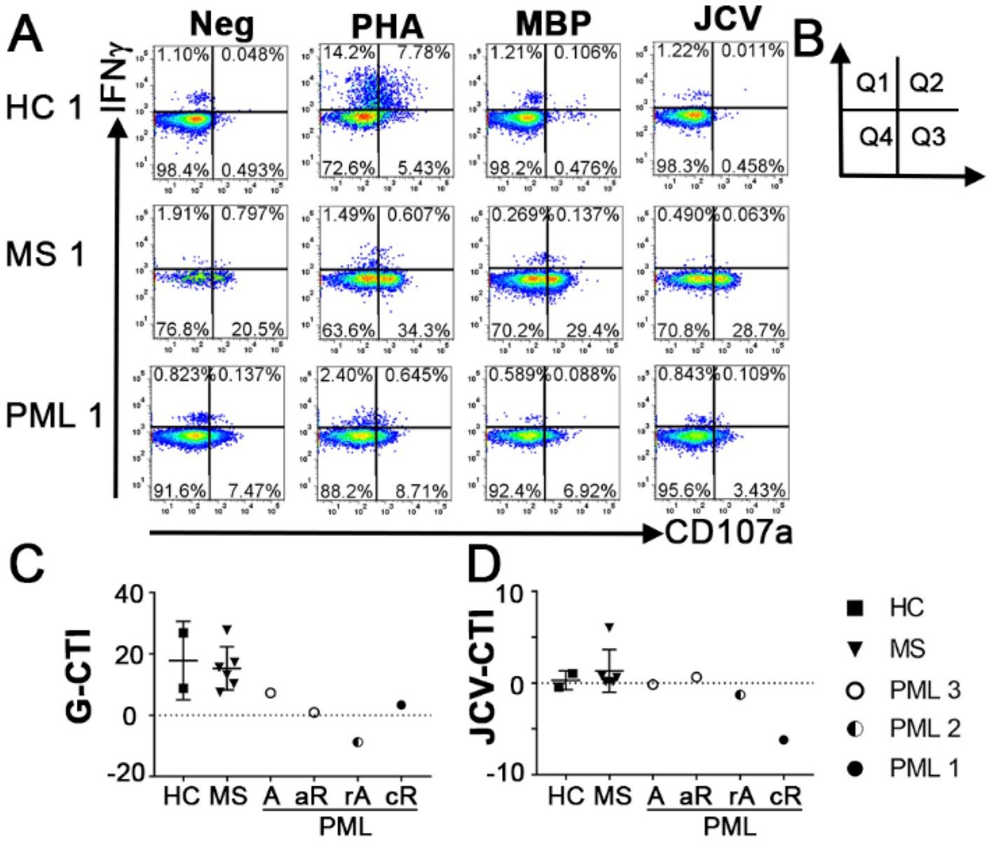 Panel A shows flow cytometry dot plots for IFNÎł and CD107a expression in HC, MS, and PML samples, under different conditions: Neg, PHA, MBP, JCV. Panel B illustrates quadrant analysis: Q1, Q2, Q3, Q4. Panel C depicts a graph of G-CTI values across HC, MS, and different PML stages. Panel D presents JCV-CTI values, also across HC, MS, and PML stages. Each data type is represented by different shapes, indicating sample groups.