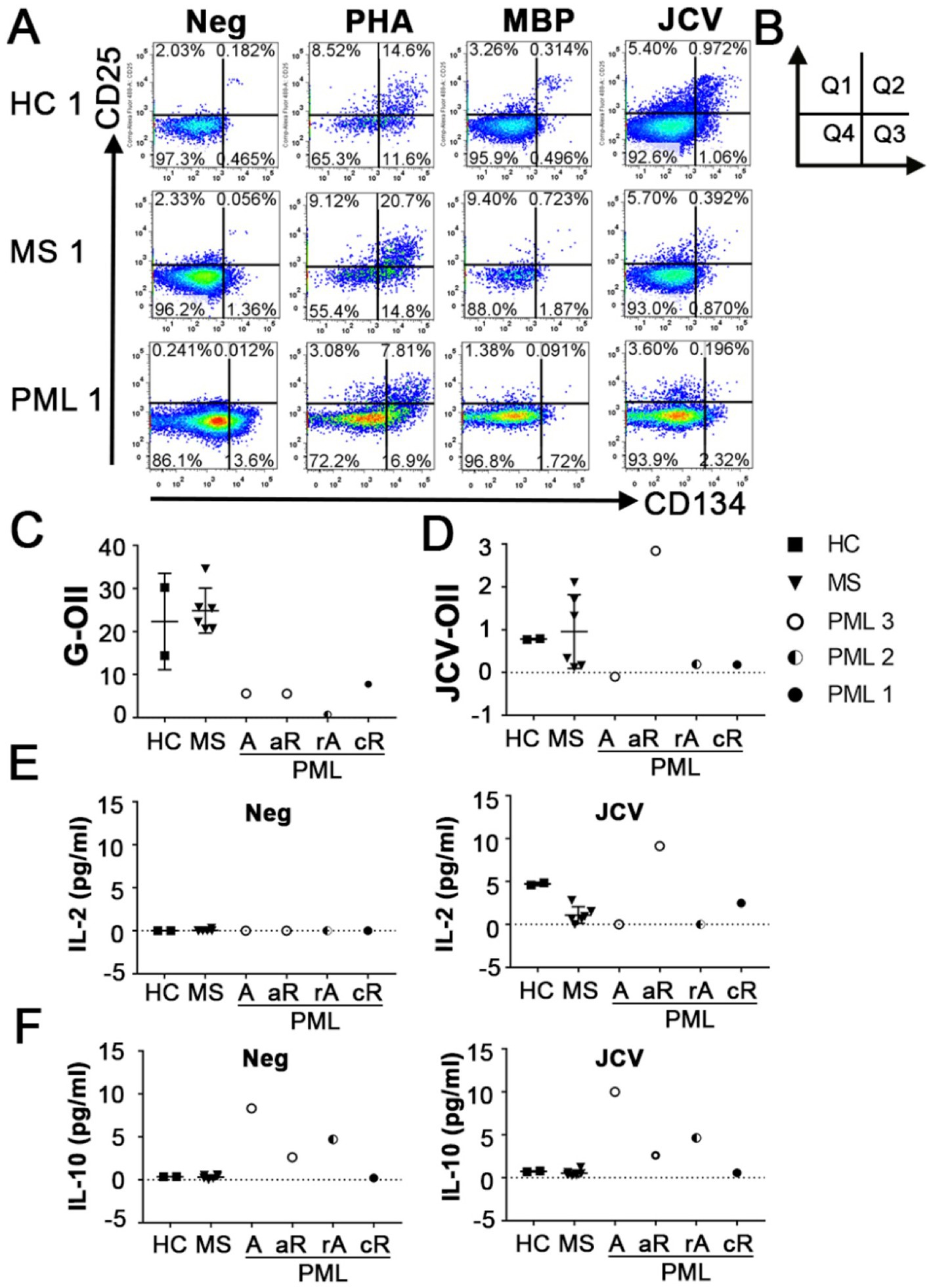 Flow cytometry and scatter plots related to immune responses in multiple sclerosis (MS) and progressive multifocal leukoencephalopathy (PML). Panel A shows dot plots of CD25 vs. CD134 expression in peripheral blood mononuclear cells from healthy controls (HC), MS, and PML patients, with different stimuli (Neg, PHA, MBP, JCV). Panel B is a quadrant reference guide. Panels C and D display scatter plots of G-OII and JCV-OII lextractions for different groups. Panels E and F show cytokine levels (IL-2 and IL-10) under different conditions. Each plot includes data from HC, MS, and PML groups.