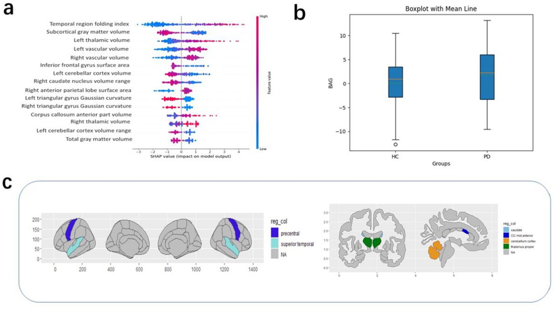 Panel a shows a SHAP summary plot analyzing the impact of various brain region volumes on model output, with feature values represented in a color gradient from blue (low) to pink (high). Panel b presents a boxplot comparing two groups, HC and PD, with mean lines visible. Panel c contains brain diagrams with colored regions indicating different brain areas, labeled in the legend, such as precentral and superior temporal regions.