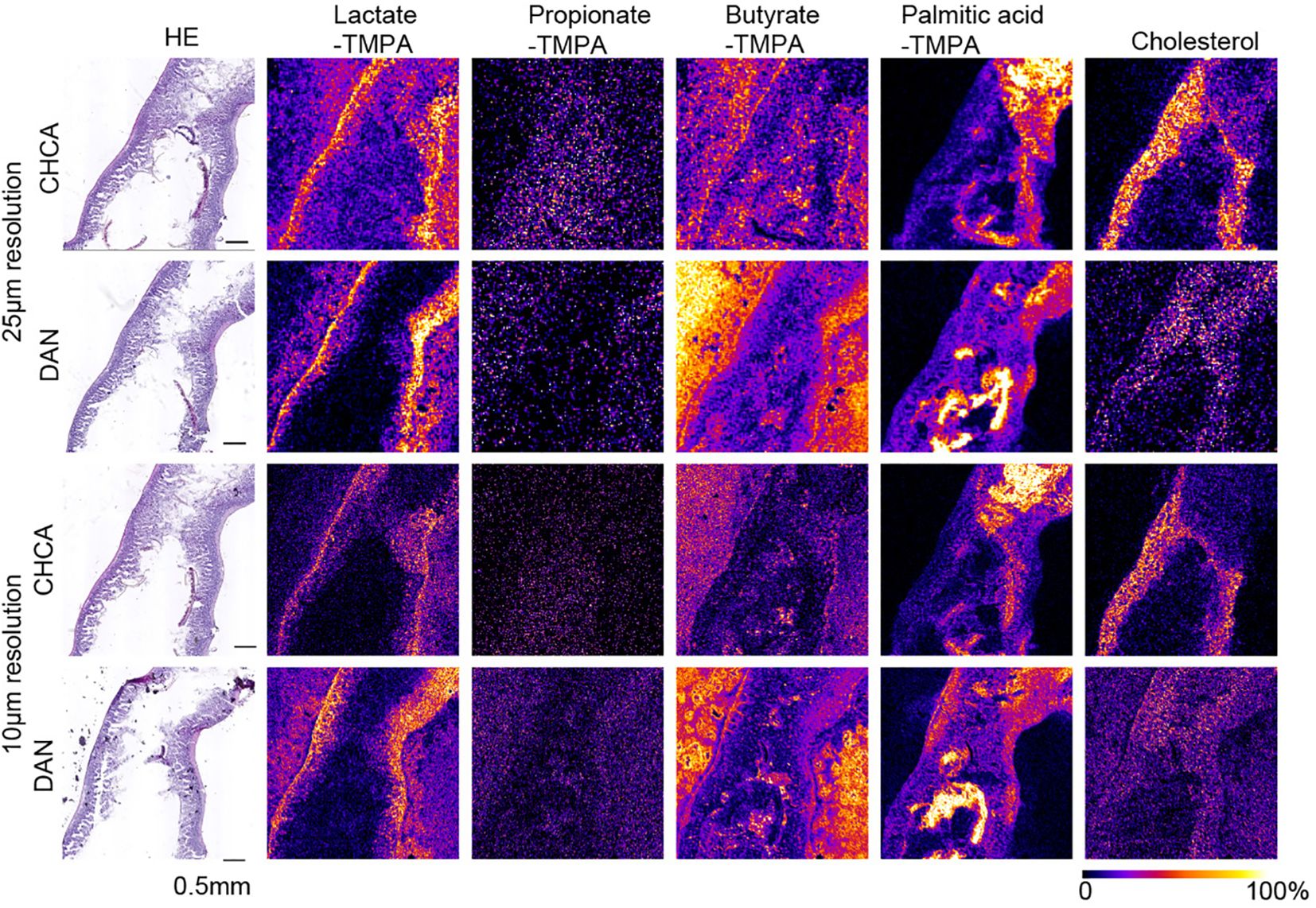 Microscopic images showing tissue sections analyzed at different resolutions (twenty-five and ten micrometers) with two different methods (CHCA and DAN). Columns depict varying metabolic compounds: lactate, propionate, butyrate, palmitic acid, and cholesterol. Colors range from purple to yellow, indicating varying concentrations from low to high. Scale bar represents 0.5 millimeters.