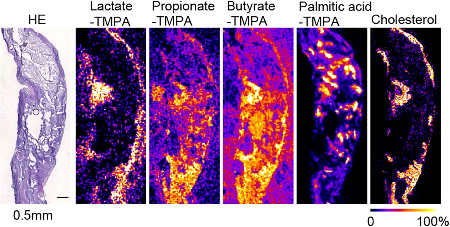 Microscopic imaging shows a series of panels: the first depicts an HE stain, and the rest show metabolic mapping with various agents—lactate, propionate, butyrate, palmitic acid, and cholesterol—using TMPA chemical derivatized technology. Color intensity indicates the concentration, from purple (low) to yellow (high). Scale bar: 0.5 mm.