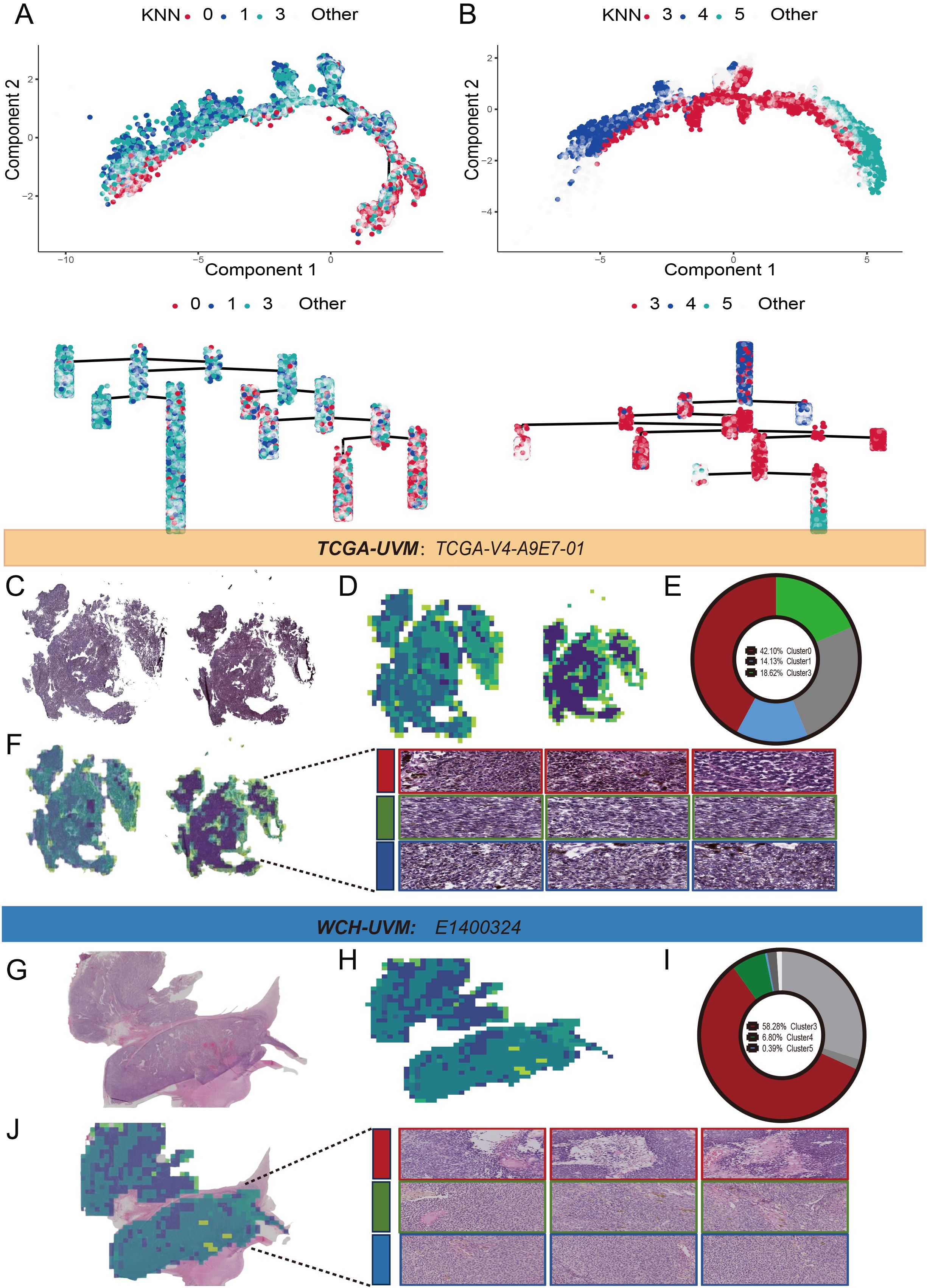 Scatter plots and dendrograms represent data clustering with k-nearest neighbors (KNN) in two separate panels labeled A and B. Different colored dots indicate clusters. Panels C and G show histological images. Panels D and H exhibit pixelated representations. Panels E and I depict pie charts showing cluster proportions. Panels F and J provide zoomed-in views with color-coded sections corresponding to specific clusters. The labels indicate “TCGA-UVM” and “WCH-UVM” with sample IDs.
