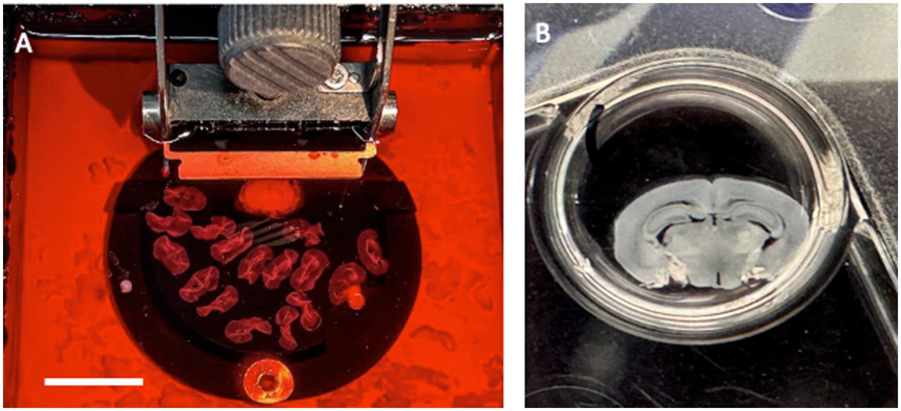A two-panel image showing brain tissue specimens. Panel A displays multiple pinkish-red brain slices on a microtome. Panel B shows a close-up of a single brain slice in a petri dish, with distinct anatomical features visible.