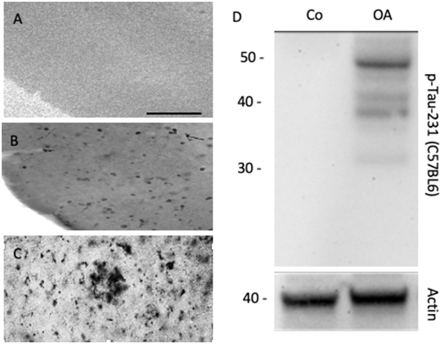Panel A shows a smooth brain tissue section. Panel B displays a brain section with scattered dark spots. Panel C depicts a brain section with a concentrated dark area. Panel D is a Western blot showing protein bands labeled Co and OA for p-Tau-231 (C57BL6) and Actin markers, with molecular weights on the left.