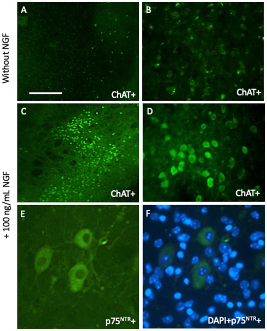 Six fluorescence microscopy images depict neural cell staining. Panels A and B show ChAT+ staining without NGF, with sparse fluorescence. Panels C and D exhibit increased ChAT+ staining with 100 ng/mL NGF, showing brighter fluorescence. Panel E presents p75^NTR+ staining with notable neural structures. Panel F combines DAPI and p75^NTR+ staining, highlighting cell nuclei in blue and neural structures in green.