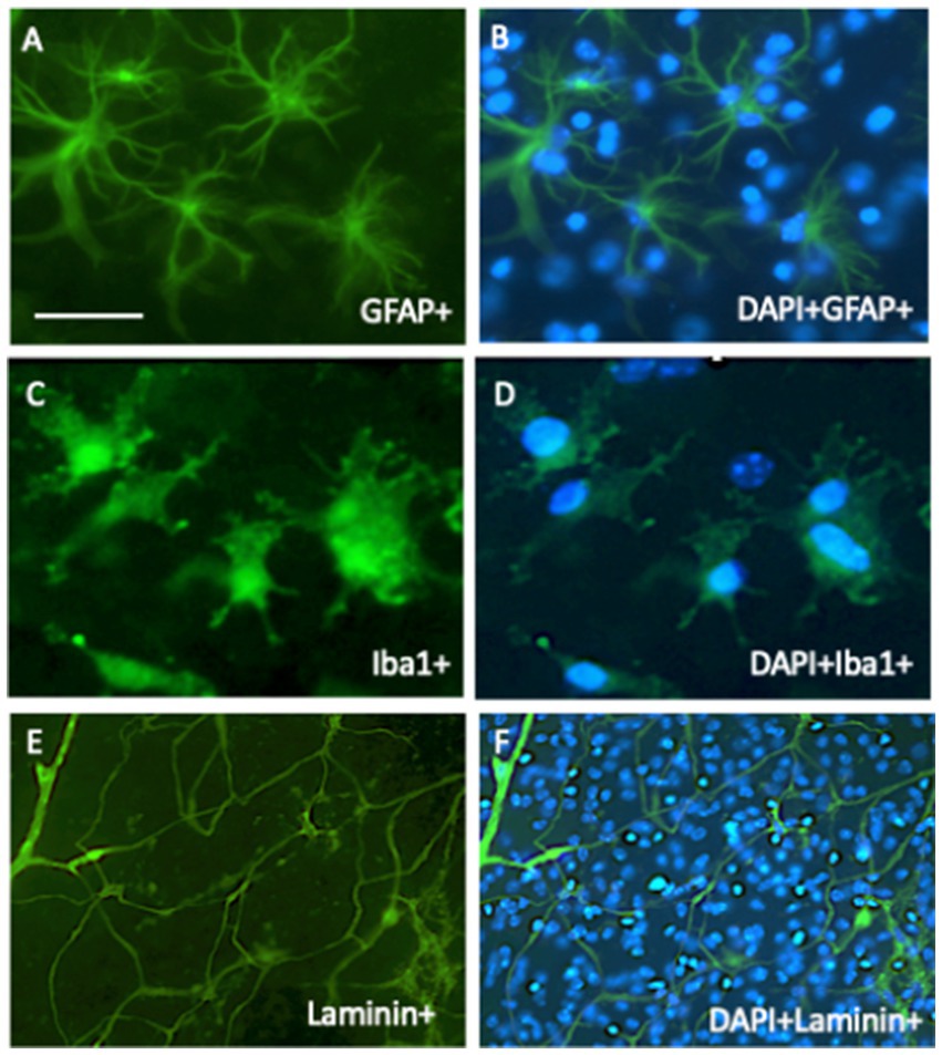 Panel A shows green-stained GFAP-positive astrocytes. Panel B displays blue and green staining for DAPI and GFAP-positive cells. Panel C shows Iba1-positive microglia in green. Panel D highlights blue-stained nuclei with green Iba1-positive cells. Panel E illustrates laminin-positive structures in green. Panel F presents DAPI-stained nuclei and green laminin-positive structures.