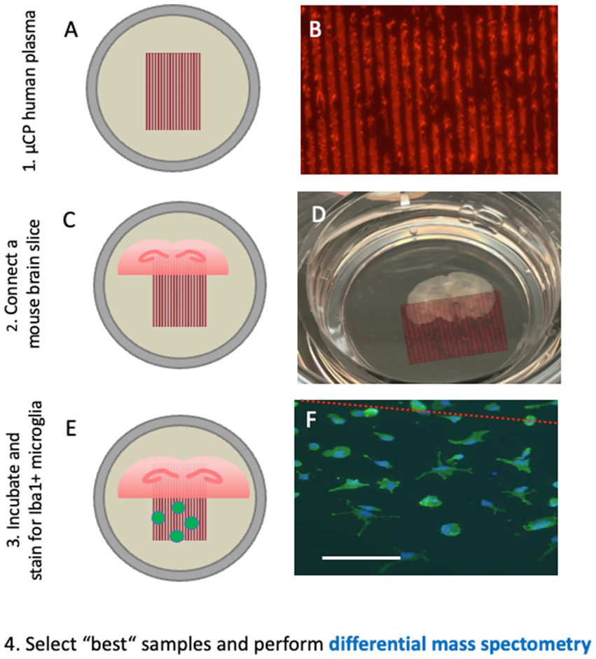 Diagram illustrating a scientific procedure involving microcontact printing (µCP) on human plasma, connecting a mouse brain slice, and incubating to stain Iba1+ microglia. Panels A, C, and E are schematic illustrations of each step. Panels B, D, and F show corresponding images: B) Close-up of printed lines on plasma; D) Brain slice submerged in liquid; F) Stained microglia under a microscope. Directions for differential mass spectrometry follow these steps.