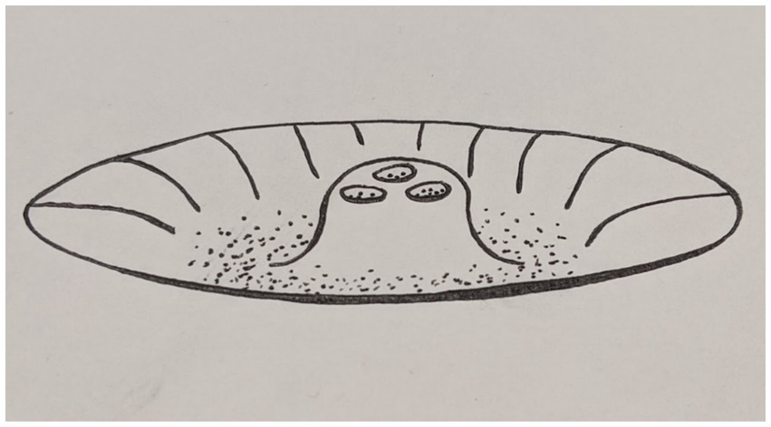 “A hand-drawn diagram of a shallow, bowl-shaped landscape with a raised central mound. Atop the mound are three smaller depressions, each containing a cluster of dots, representing distinct stable states. The overall image illustrates a multi-stable attractor landscape, where multiple stable points exist within the system.”