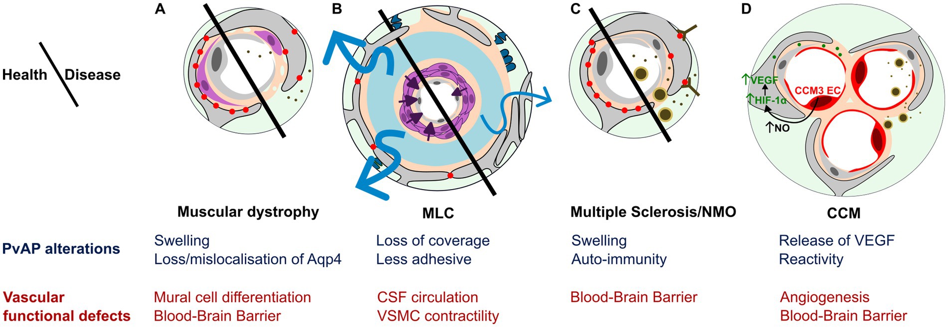 Diagram depicting mechanisms by which diseases affect health through PvAP alterations and vascular functional defects. Panels illustrate muscular dystrophy, megalencephalic leukoencephalopathy with subcortical cysts (MLC), multiple sclerosis/neuromyelitis optica (NMO), and cerebral cavernous malformations (CCM). Each disease shows distinct cellular and molecular changes, such as swelling, loss of coverage, and blood-brain barrier disruption. Key components like Aqp4, VEGF, and HIF-1α are noted, along with processes like mural cell differentiation and angiogenesis. A dividing line separates health from disease in each case.