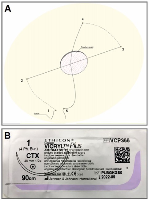 Diagram labeled \
