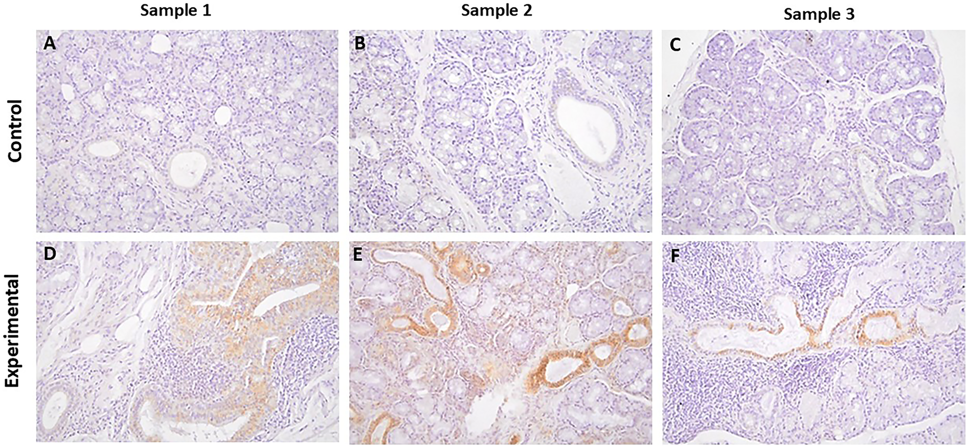 Microscopic images of tissue samples. Three control samples (A, B, C) and three experimental samples (D, E, F) are shown. Control samples exhibit uniform light purple staining, while experimental samples display distinct orange-brown staining, indicating a difference in expression or treatment effects.