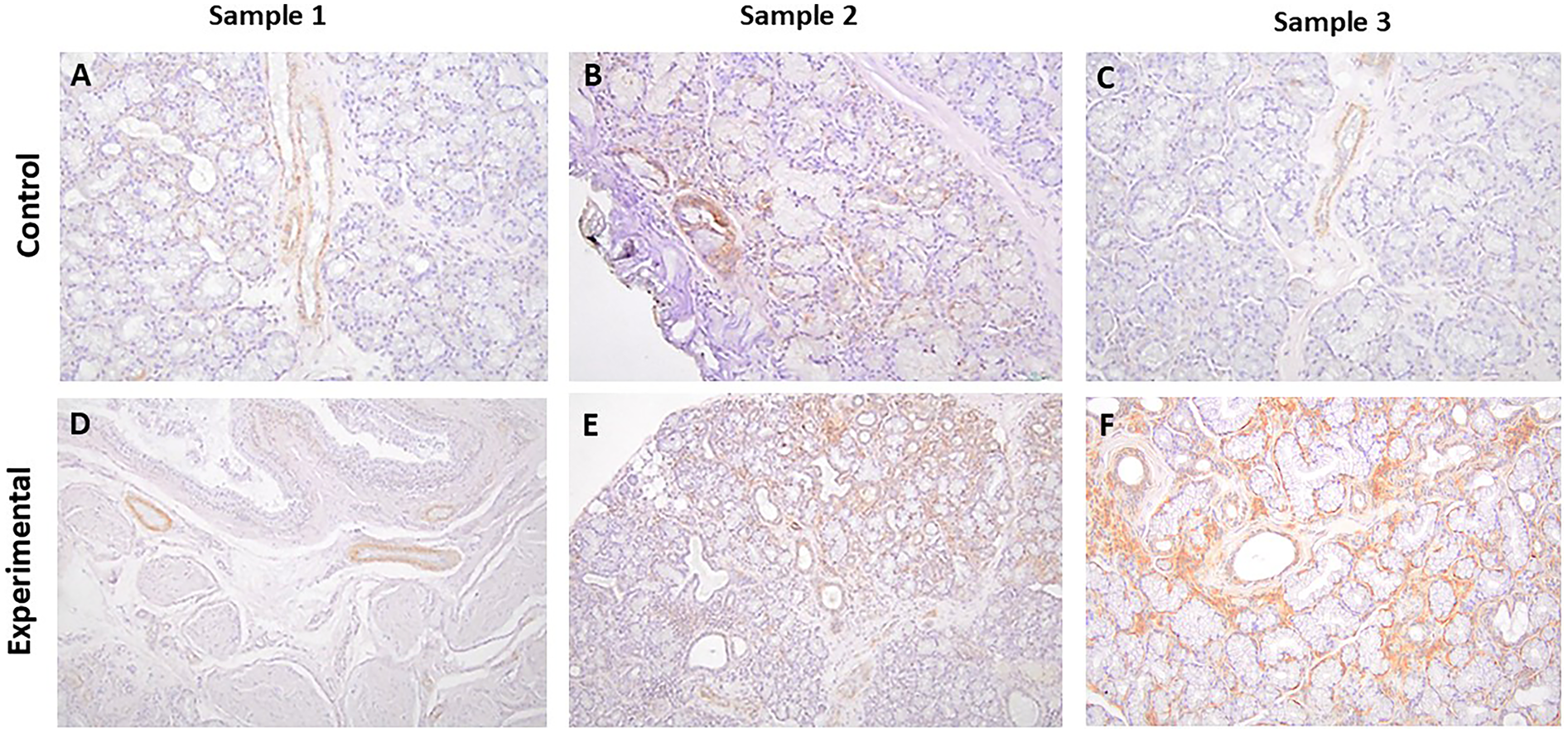 Histological analysis showing control and experimental samples with staining differences. Panels A, B, and C represent the control group for Samples 1, 2, and 3, showing lighter staining patterns. Panels D, E, and F represent the experimental group, where increased staining intensity is observed, indicating a difference in cellular or molecular composition.