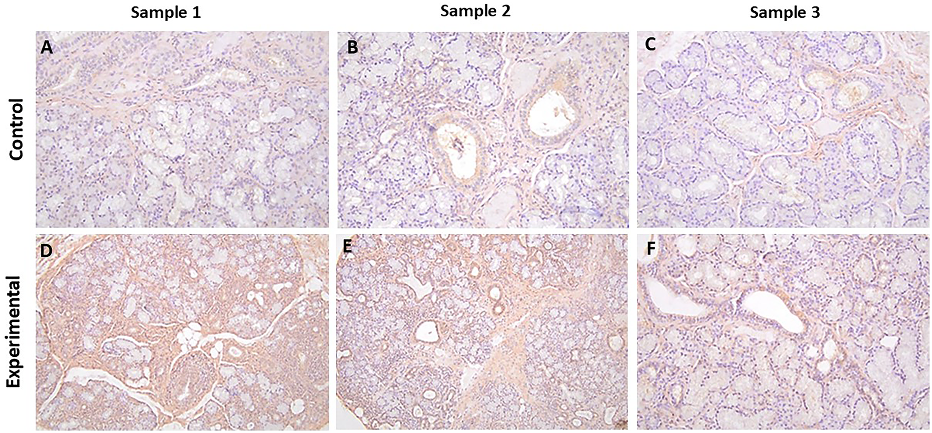 Histological comparison of control and experimental groups across three samples. Panels A-C display control tissue with lighter staining, indicating less marker presence. Panels D-F show experimental tissue with darker staining, indicating increased marker presence. Each row represents a group, and each column a sample.