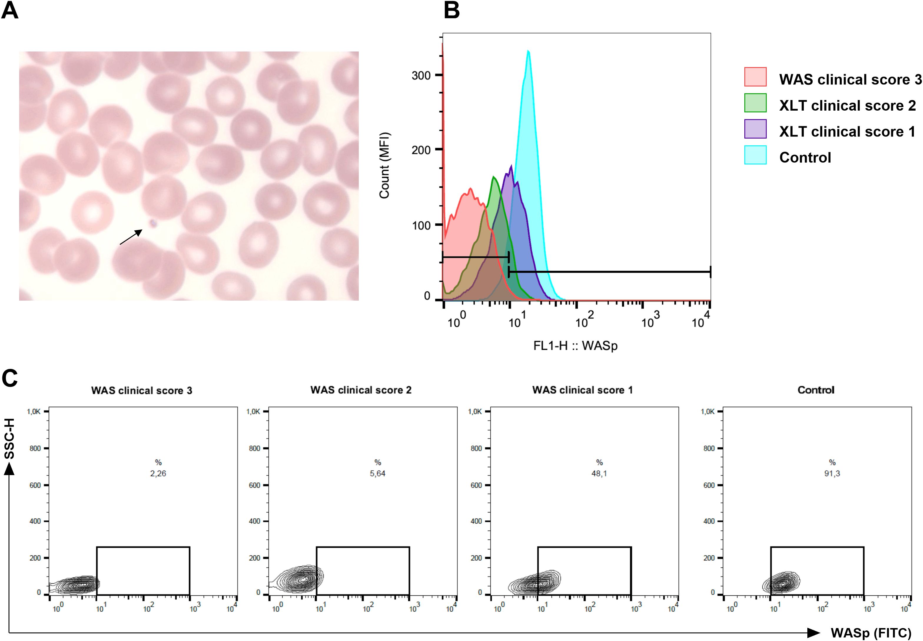 Panel A shows a microscopic image of red blood cells with an arrow indicating a small platelet. Panel B presents a histogram of flow cytometry data illustrating WASp expression levels with different clinical scores and a control group. Panel C displays dot plots comparing side scatter and WASp expression for various WAS clinical scores and a control, showing percentages within defined gates.