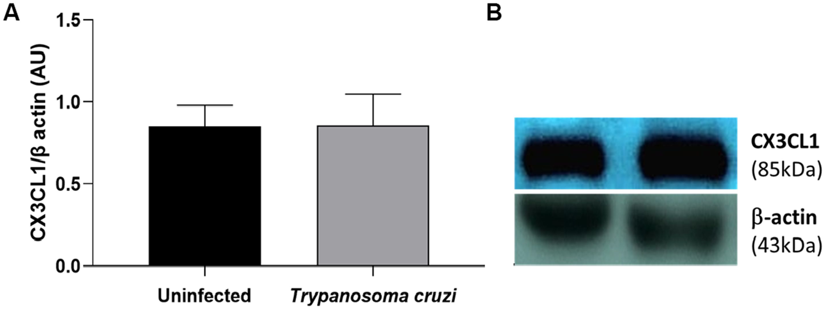 Bar graph comparing the levels of CX3CL1 normalized to β-actin in uninfected and Trypanosoma cruzi-infected samples. The graph shows no significant difference between the two groups. Adjacent to the graph, Western blot images display bands for CX3CL1 (eighty-five kilodaltons) and β-actin (forty-three kilodaltons) for both conditions.