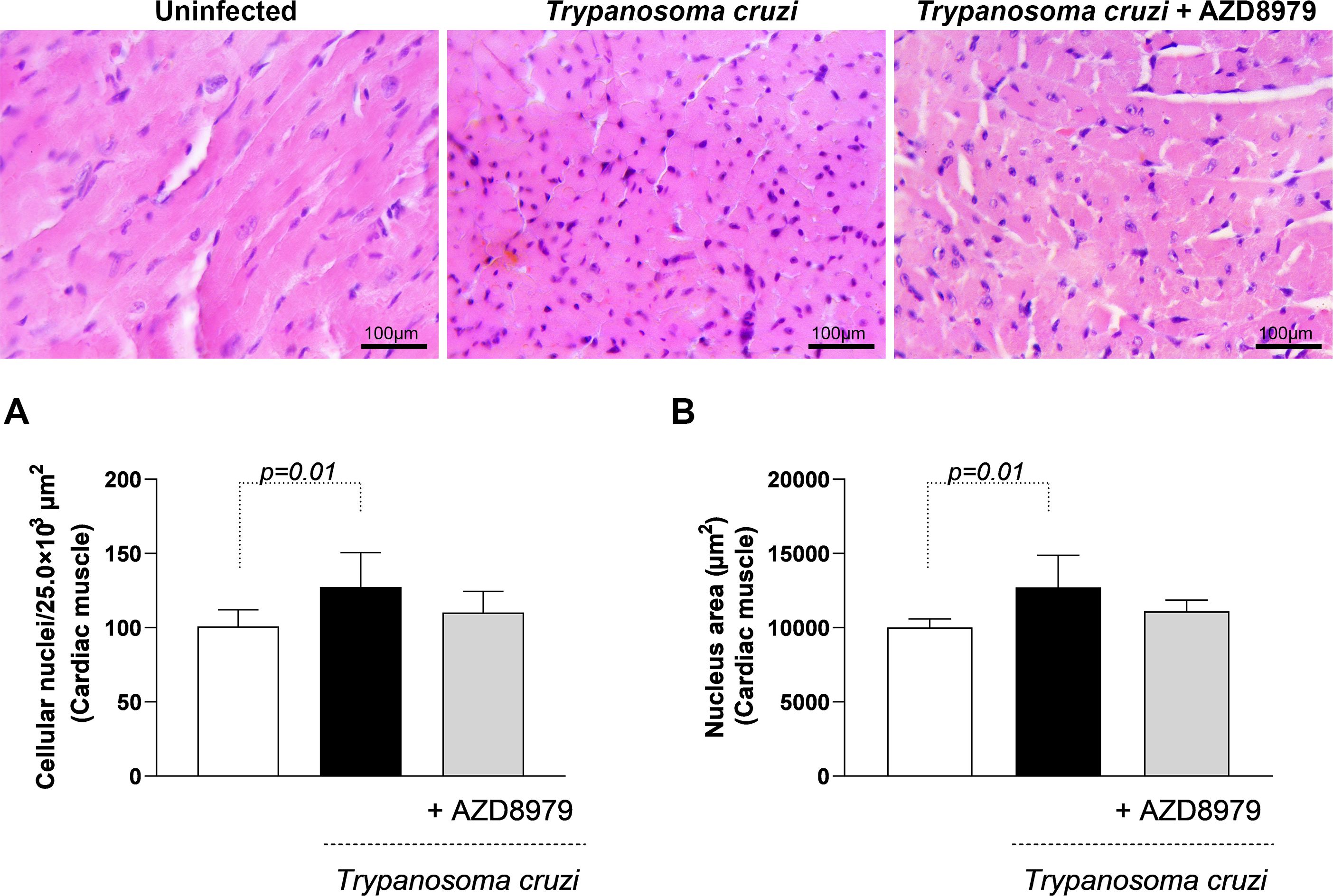 The image consists of histological sections and bar graphs. The top row shows three stained tissue sections: uninfected, Trypanosoma cruzi infected, and Trypanosoma cruzi infected with AZD8979 treatment. Each section shows variation in cellular nuclei. The bottom part includes two bar graphs labeled A and B. Graph A compares cellular nuclei density, and Graph B compares nucleus area in cardiac muscle, both showing significant differences with p=0.01 for treatments, emphasizing the effect of AZD8979.