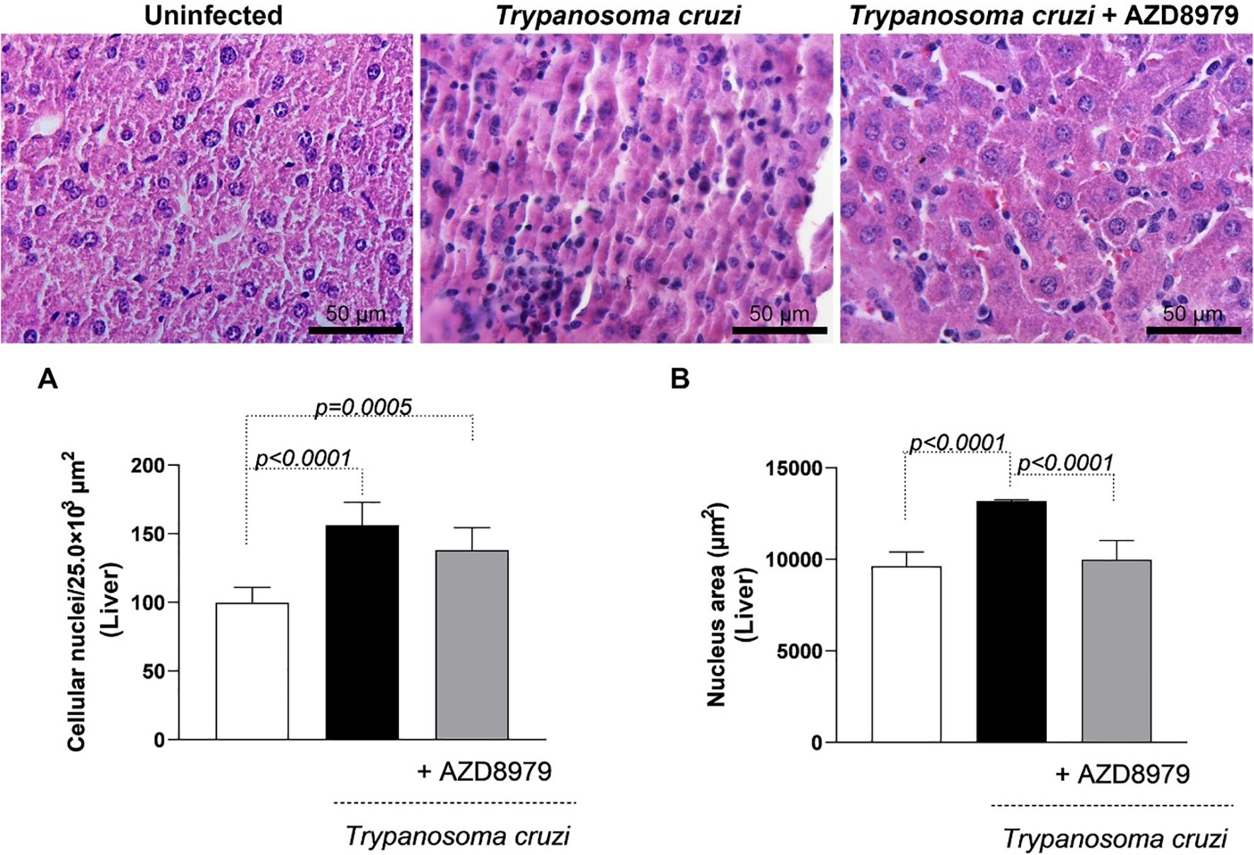 Three liver tissue micrographs show comparison among uninfected tissue, Trypanosoma cruzi infection, and Trypanosoma cruzi treatment with AZD8979. Below, bar graphs A and B display cellular nuclei count and nucleus area in micrometers squared, respectively. Statistical significance is indicated with p-values.