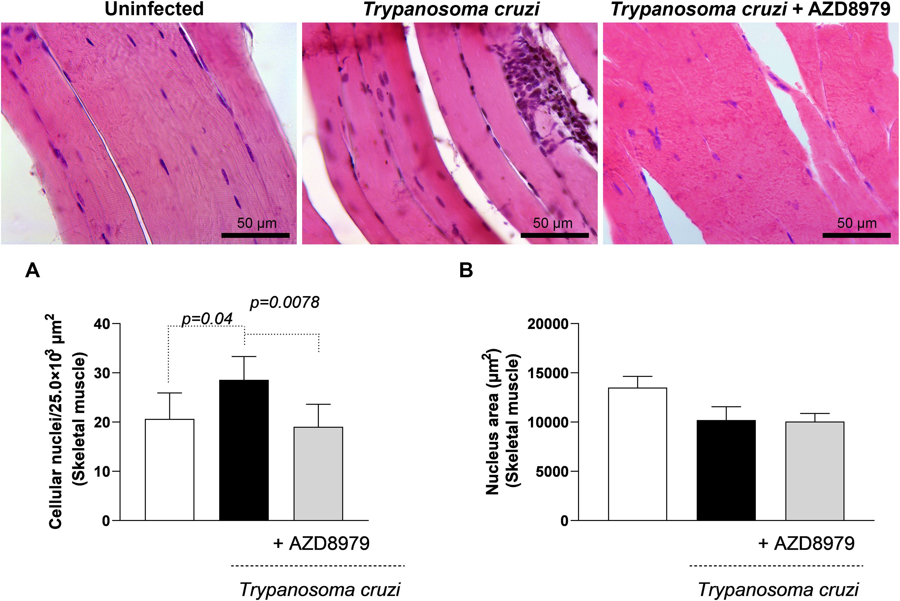 Histological images and bar graphs depicting skeletal muscle samples. The images show uninfected muscle, muscle infected with *Trypanosoma cruzi*, and infected muscle treated with AZD8979, with differences in cellular structure. Bar graph A shows cellular nuclei count, highlighting significant increases when infected with *Trypanosoma cruzi*. Bar graph B displays nucleus area, with no significant differences across conditions. Scale bars represent 50 micrometers.