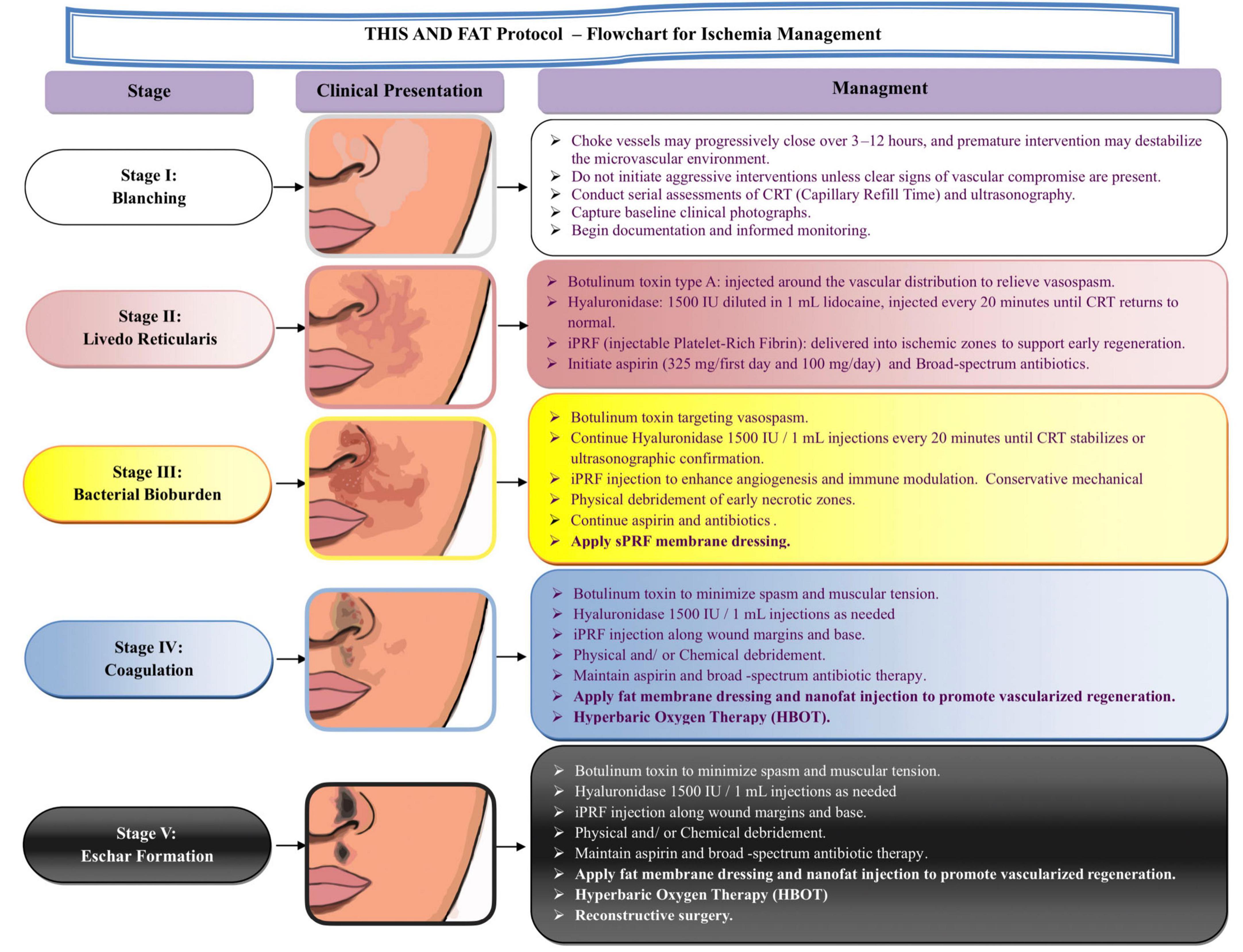 Flowchart titled “THIS AND FAT Protocol - Flowchart for Ischemia Management” shows five stages of clinical presentation with associated management strategies. Stage I: Blanching advises against aggressive interventions and emphasizes documentation. Stage II: Livedo Reticularis suggests botulinum toxin, hyaluronidase, iPRF injections, and aspirin. Stage III: Bacterial Bioburden continues toxin treatment, hyaluronidase, iPRF injections, and antibiotics. Stage IV: Coagulation adds fat membrane dressing and hyperbaric oxygen therapy. Stage V: Eschar Formation includes physical debridement, reconstruction, and continuation of previous treatments. Each stage features illustrations of a nose showing varying levels of ischemia signs.