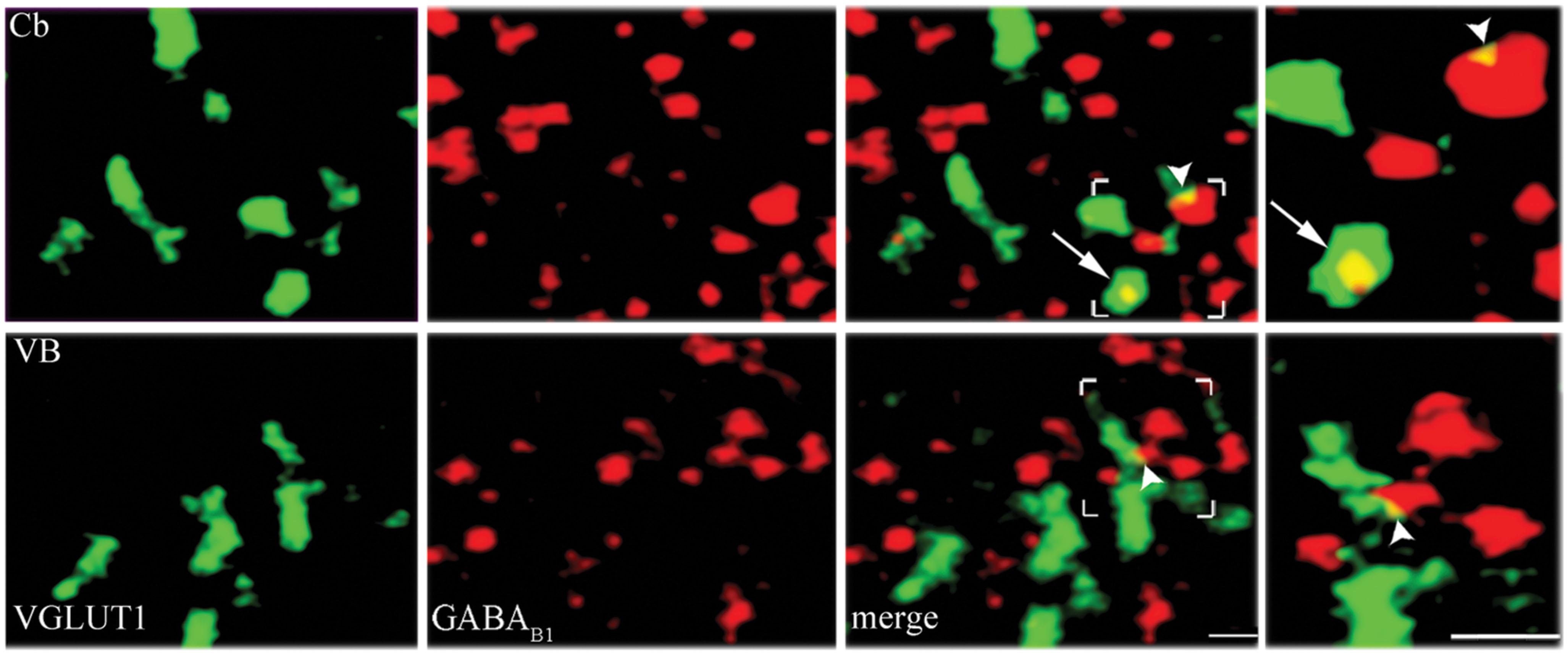 Frontiers | Differential expression of metabotropic