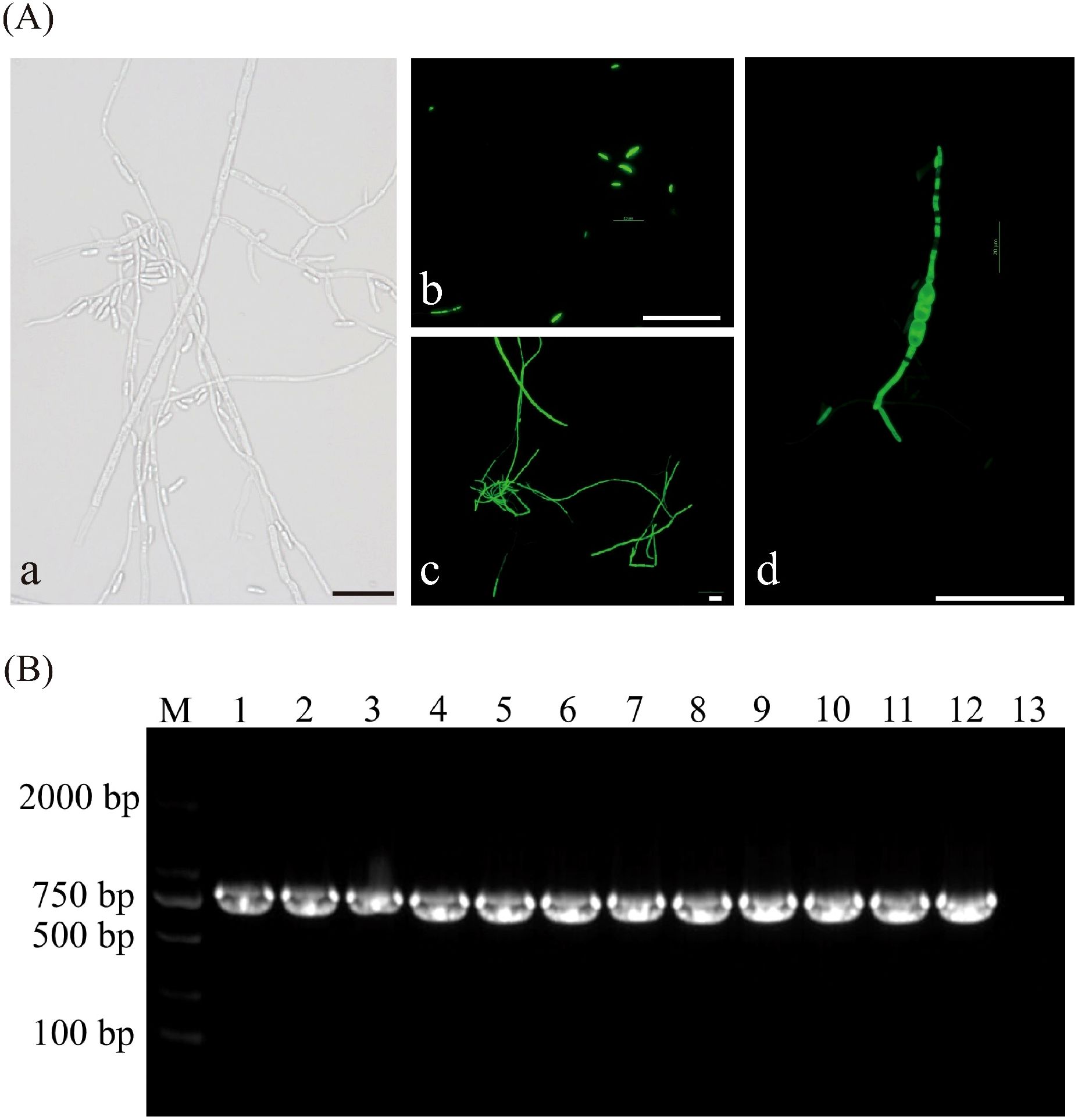 A) Four panels showing microscopic images of fungal structures. (a) Light micrograph of branching hyphae. (b-d) Fluorescent images highlighting different fungal structures in green. Bars indicate scale. B) Gel electrophoresis image showing DNA bands across wells labeled M and numbers one to thirteen, with markers for 2000, 750, 500, and 100 base pairs.