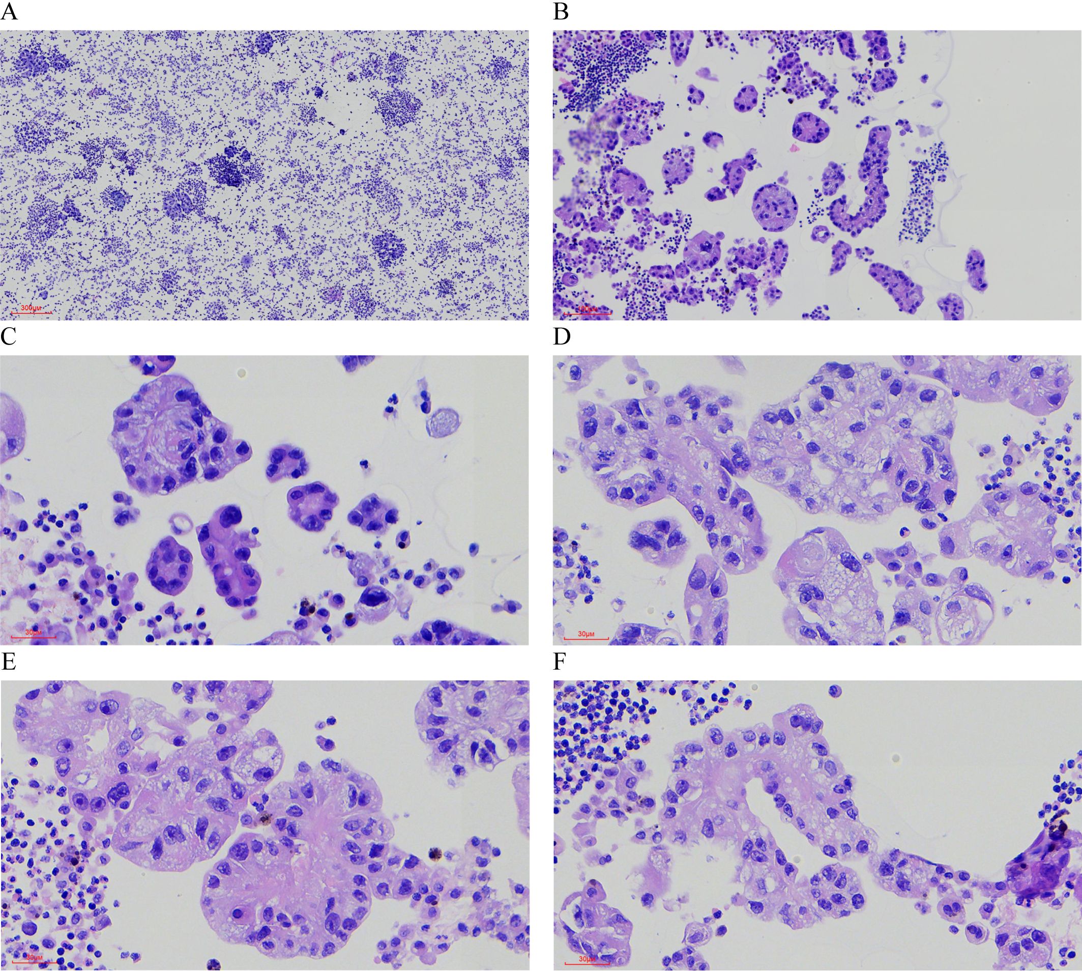 Microscopic images labeled A through F show stained cellular samples under various magnifications. Image A displays a wide view with scattered cell clusters. Images B to F highlight closer views, revealing variations in cell shapes and densities. The images feature purple-stained cells against a light background, with a scale bar in the lower left of each image.