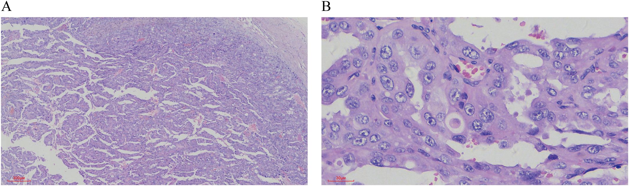 Panel A shows a low magnification micrograph with extensive tissue structures stained in purple and pink. Panel B presents a higher magnification revealing individual cells with visible nuclei, also stained in purple with pink tones. Both images are labeled with scale bars.
