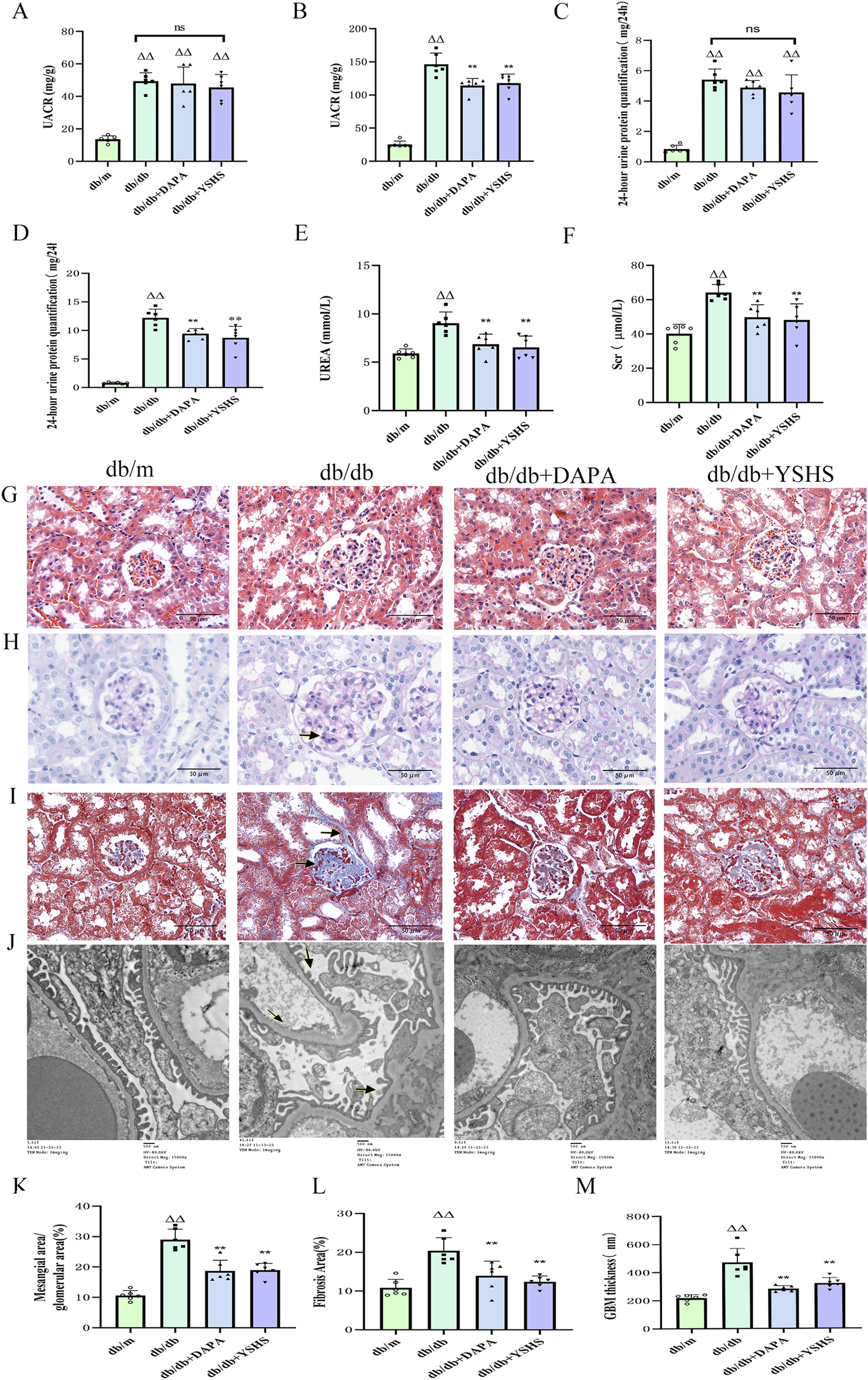 Group of scientific images and charts comparing kidney-related metrics and histology in four groups: db/m, db/db, db/db+DAPA, and db/db+YSHS. Charts (A-F, K-M) display measurements like UACR, urea, and fibrosis levels with statistical markers. Histology images (G-J) show tissue samples with variations in structure and staining patterns across groups. Scale bars and labeled arrows indicate notable features. Statistical significance is denoted by symbols such as double delta or asterisks.